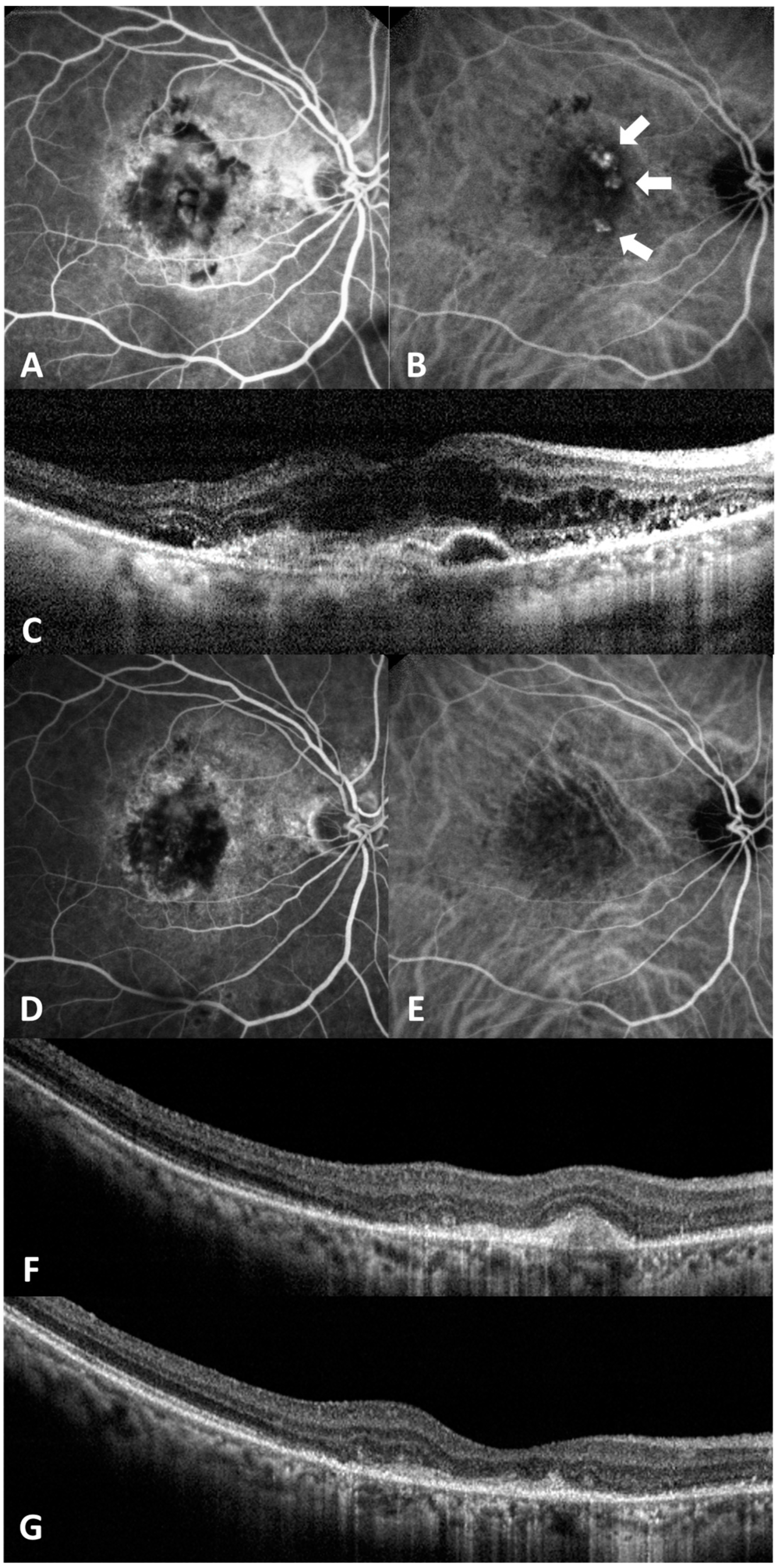 Medicina 60 01311 g004