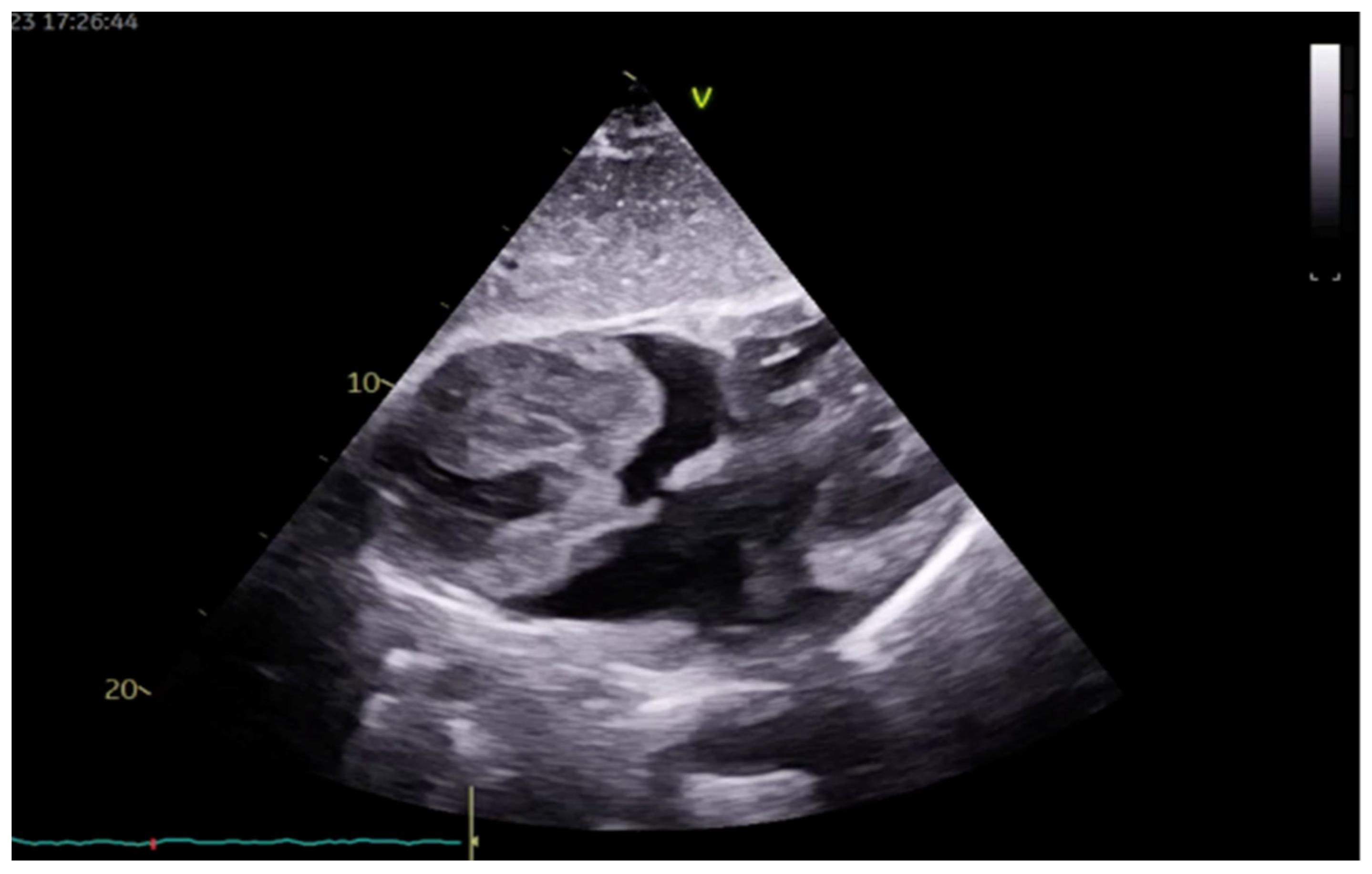 Medicina 60 01321 g001