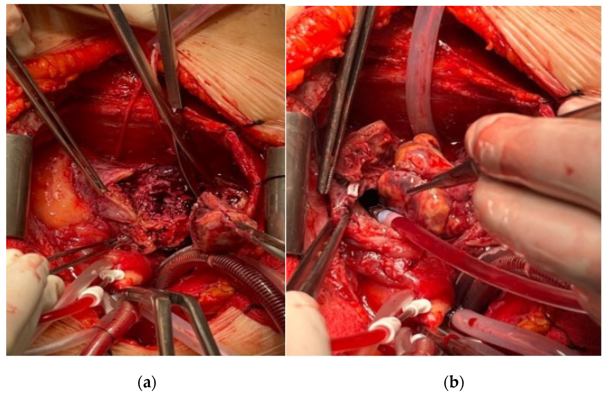 Medicina 60 01321 g002