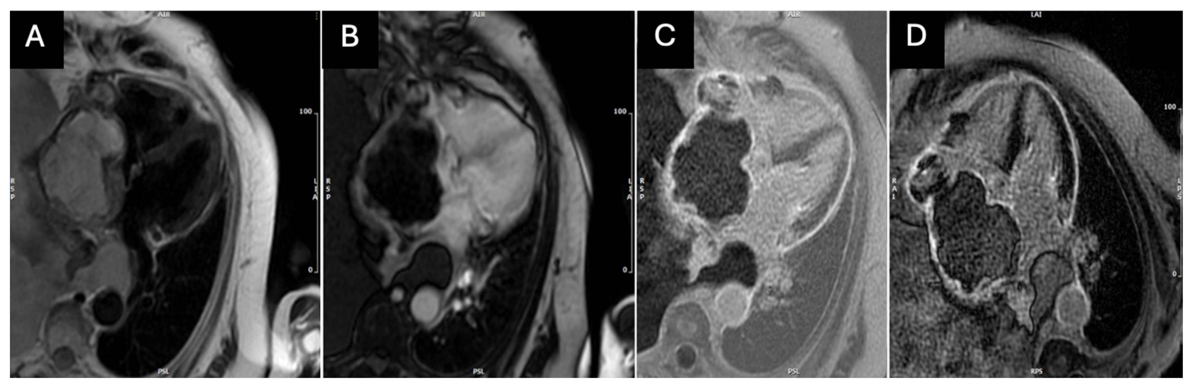 Medicina 60 01321 g004