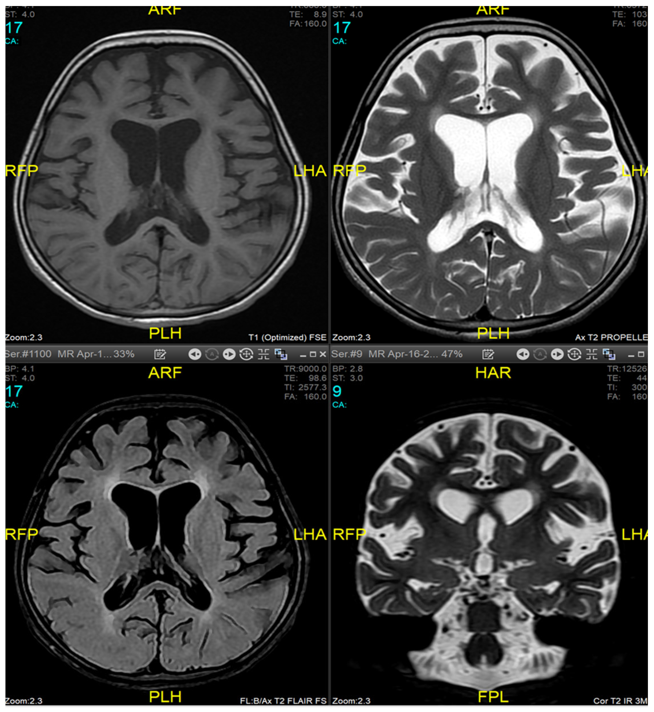 Medicina 60 01322 g001