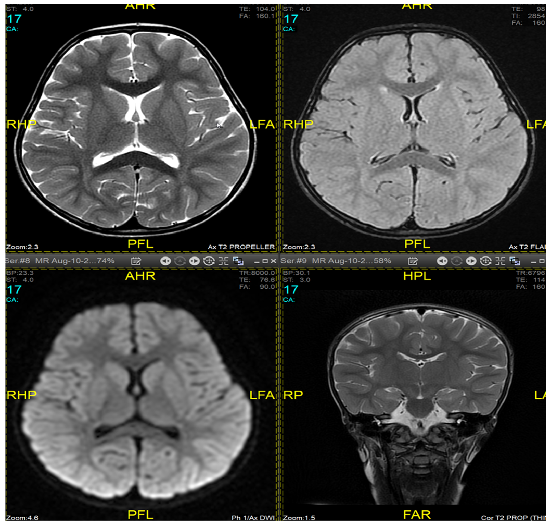 Medicina 60 01322 g002