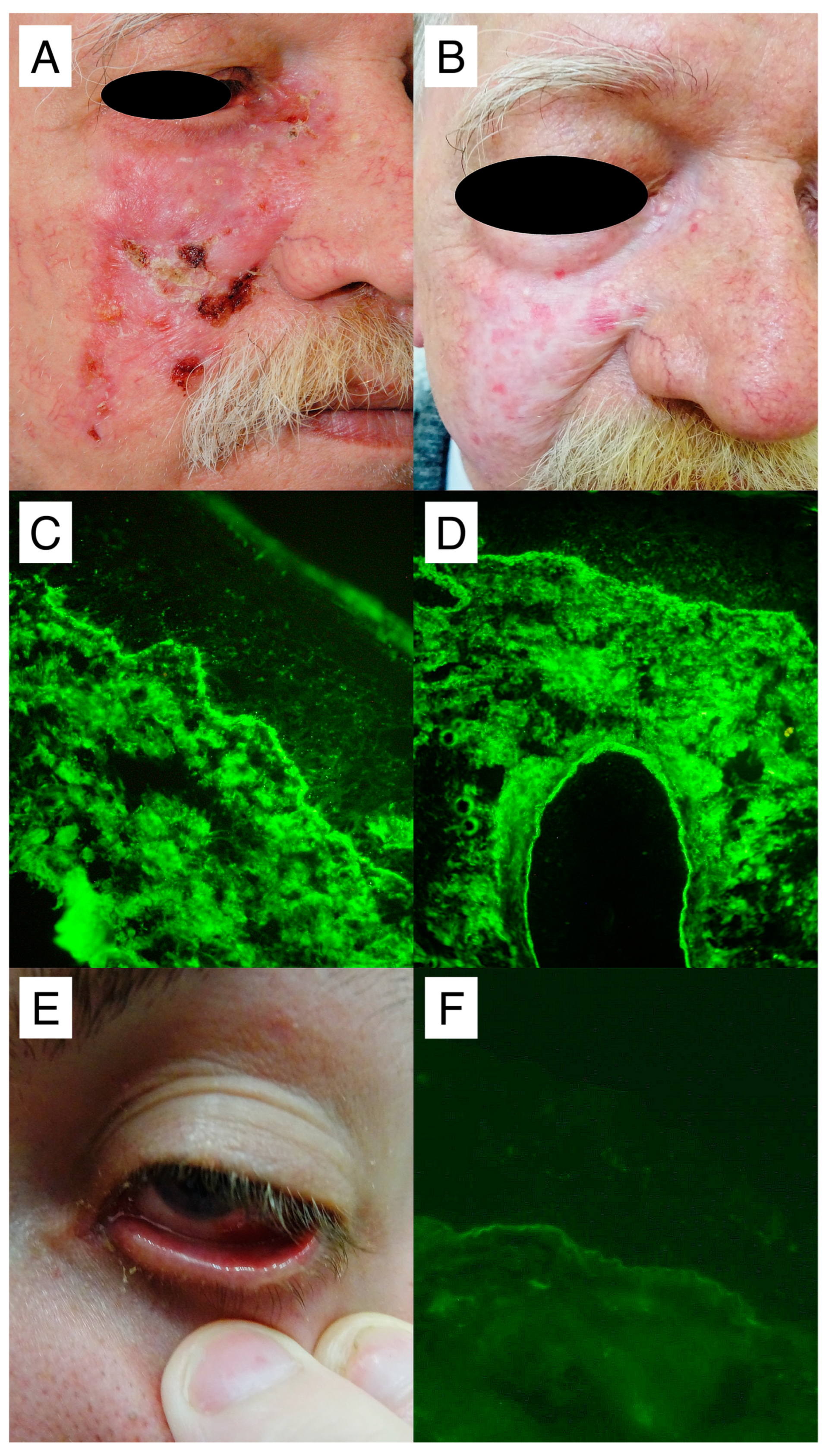 Medicina 60 01324 g005