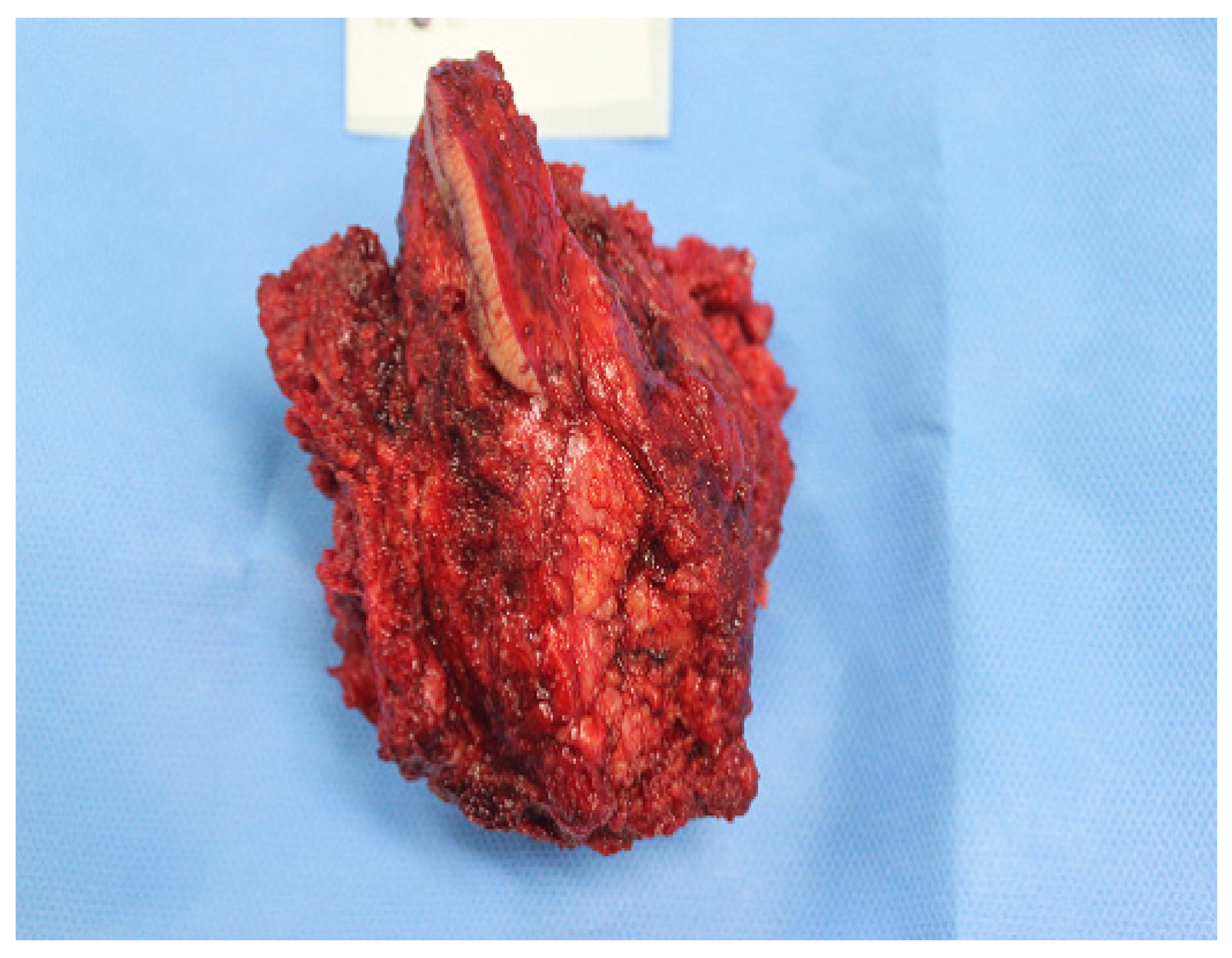 Medicina 60 01365 g004