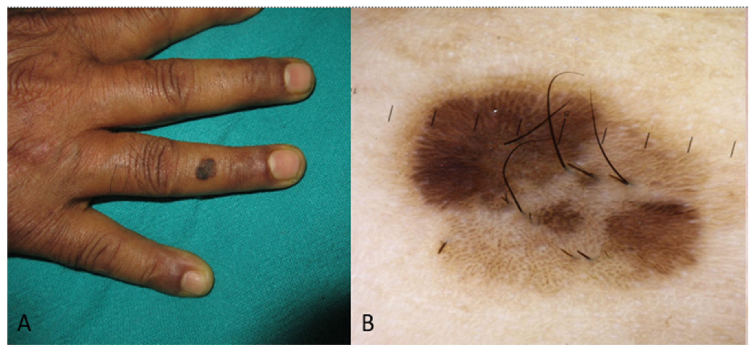 Medicina 60 01386 g002 Medicina 60 01386 g002