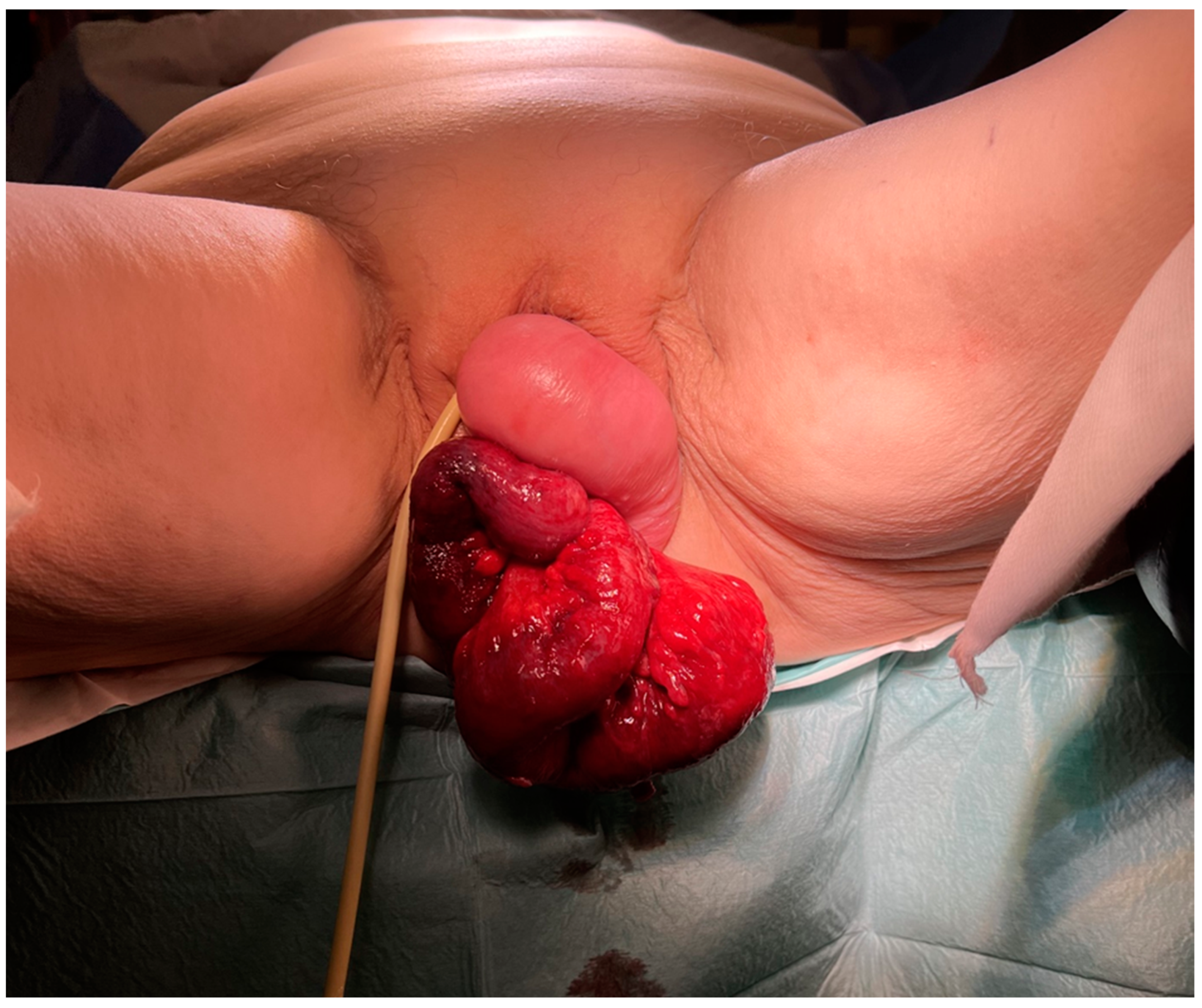 Medicina 60 01388 g001