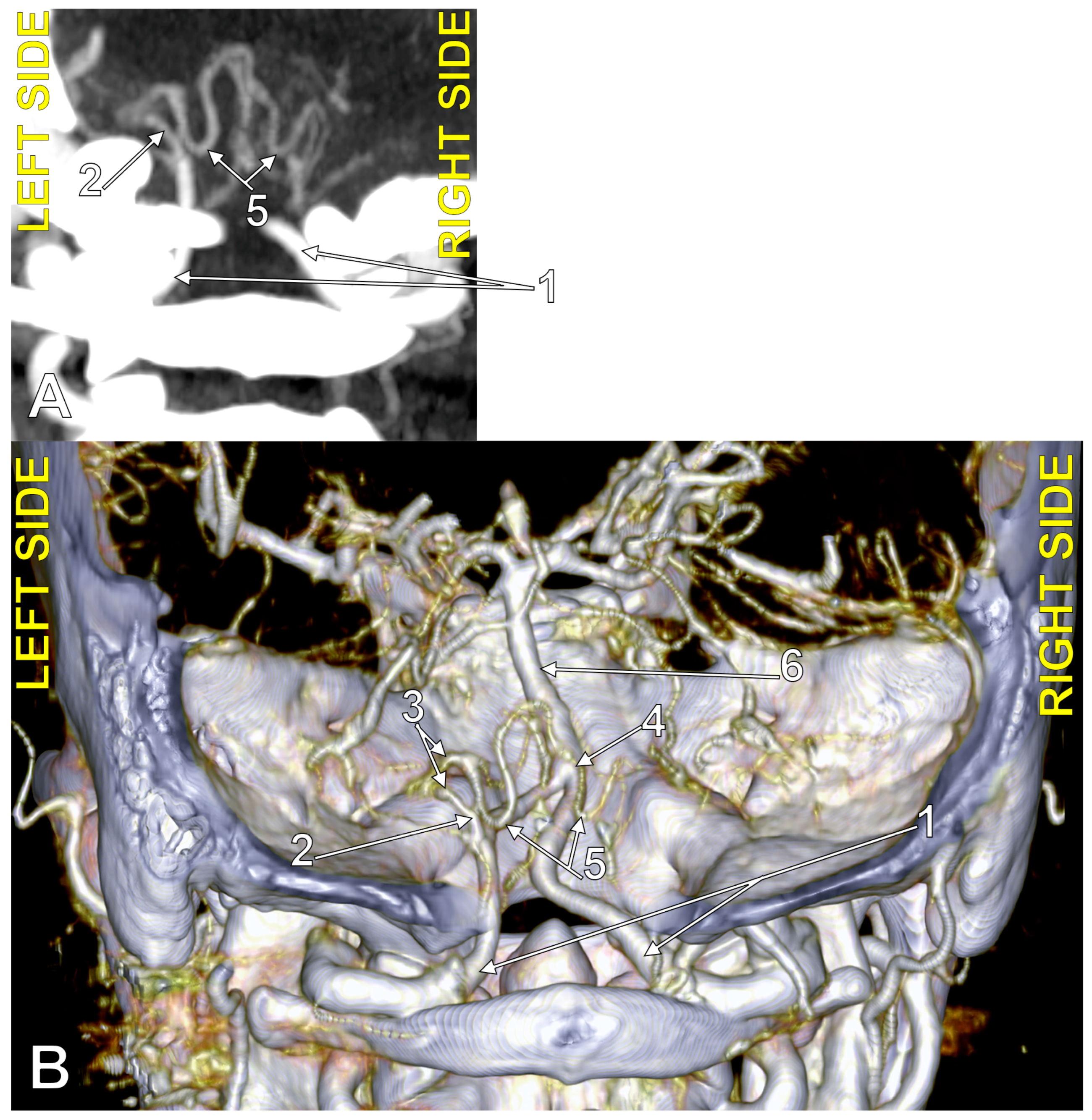 Medicina 60 01397 g004