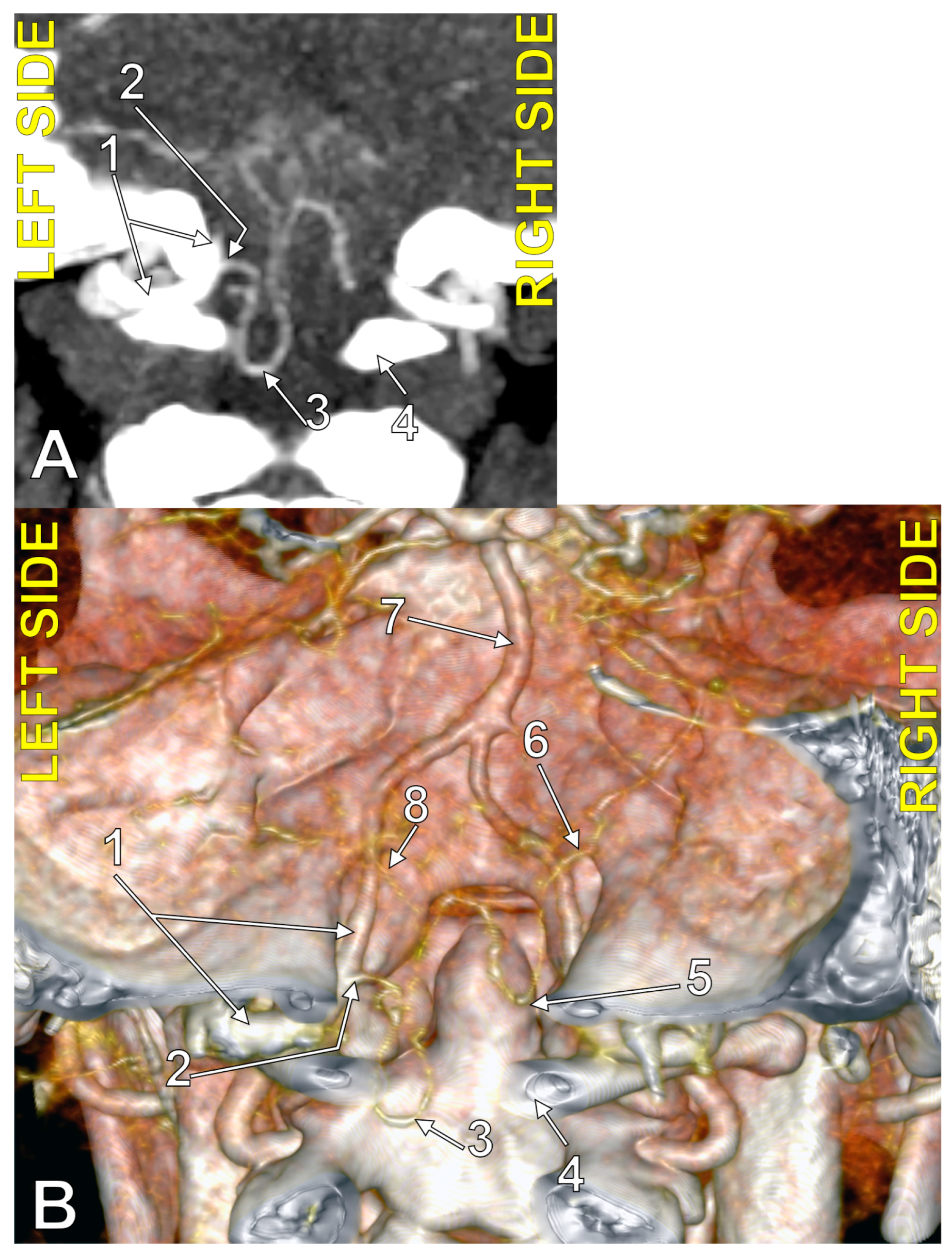 Medicina 60 01397 g005