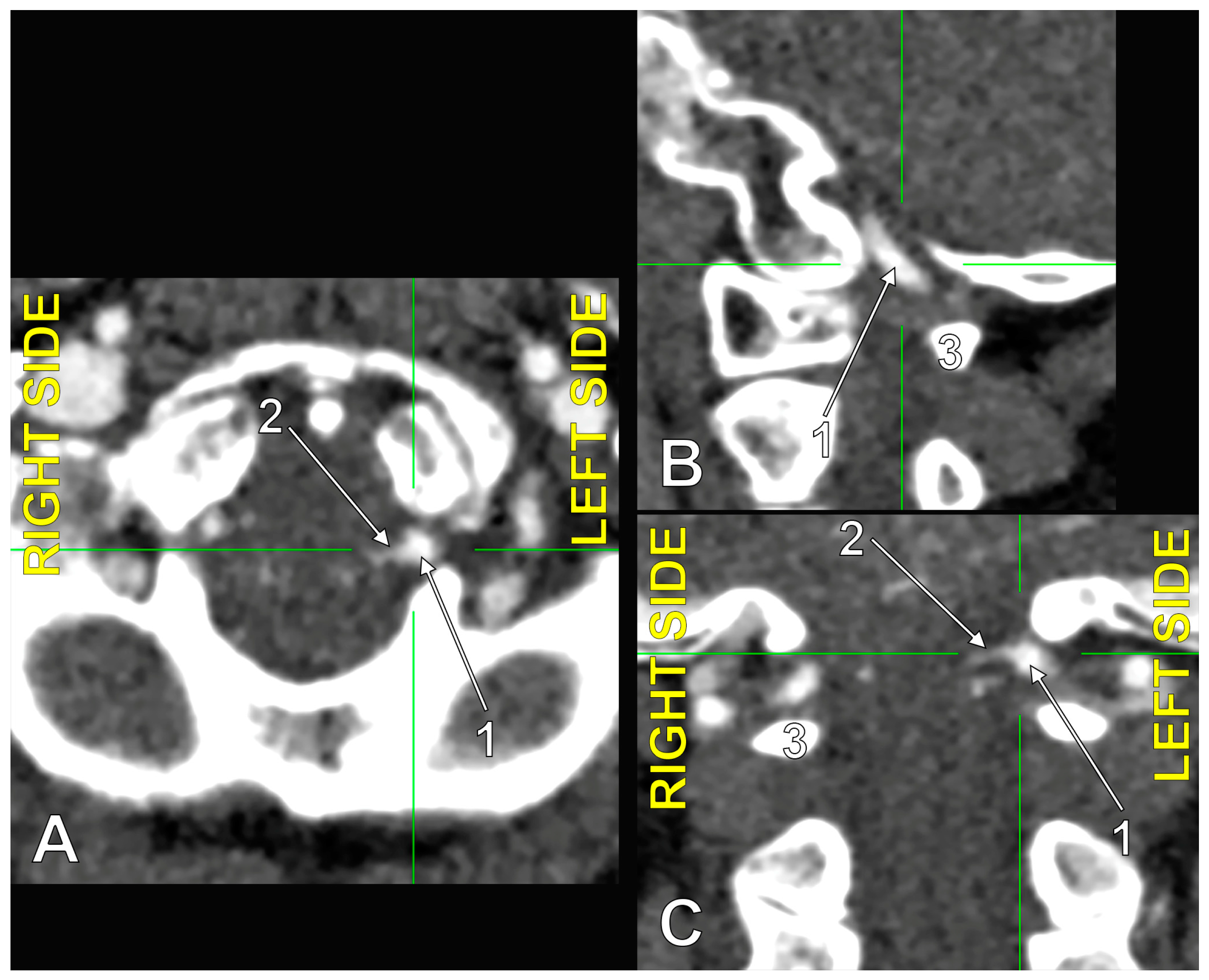Medicina 60 01397 g006
