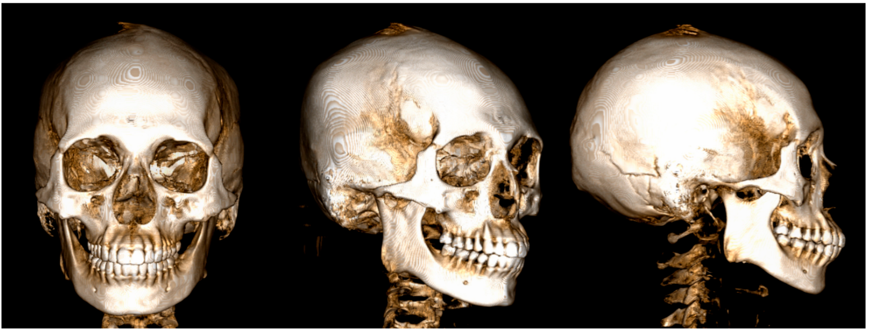 Medicina 60 01400 g001 Medicina 60 01400 g001