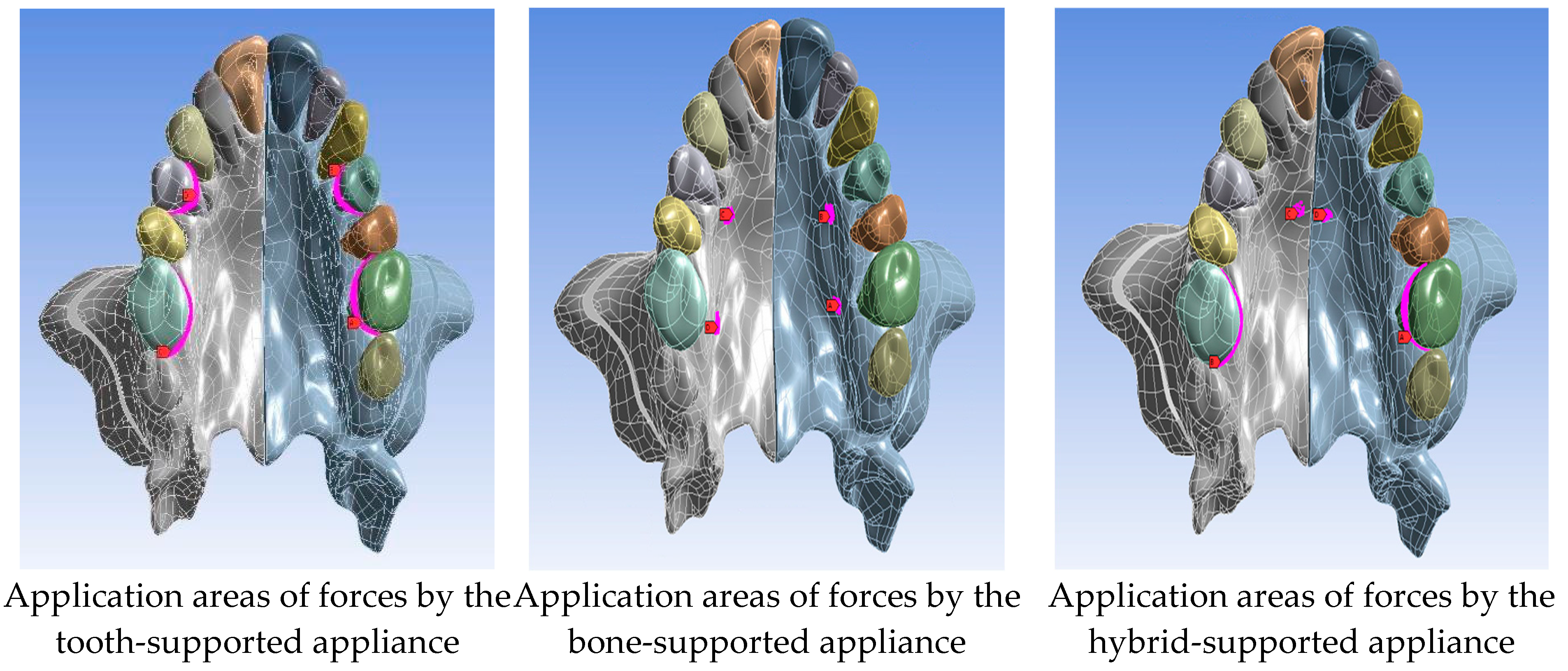 Medicina 60 01400 g003 Medicina 60 01400 g003