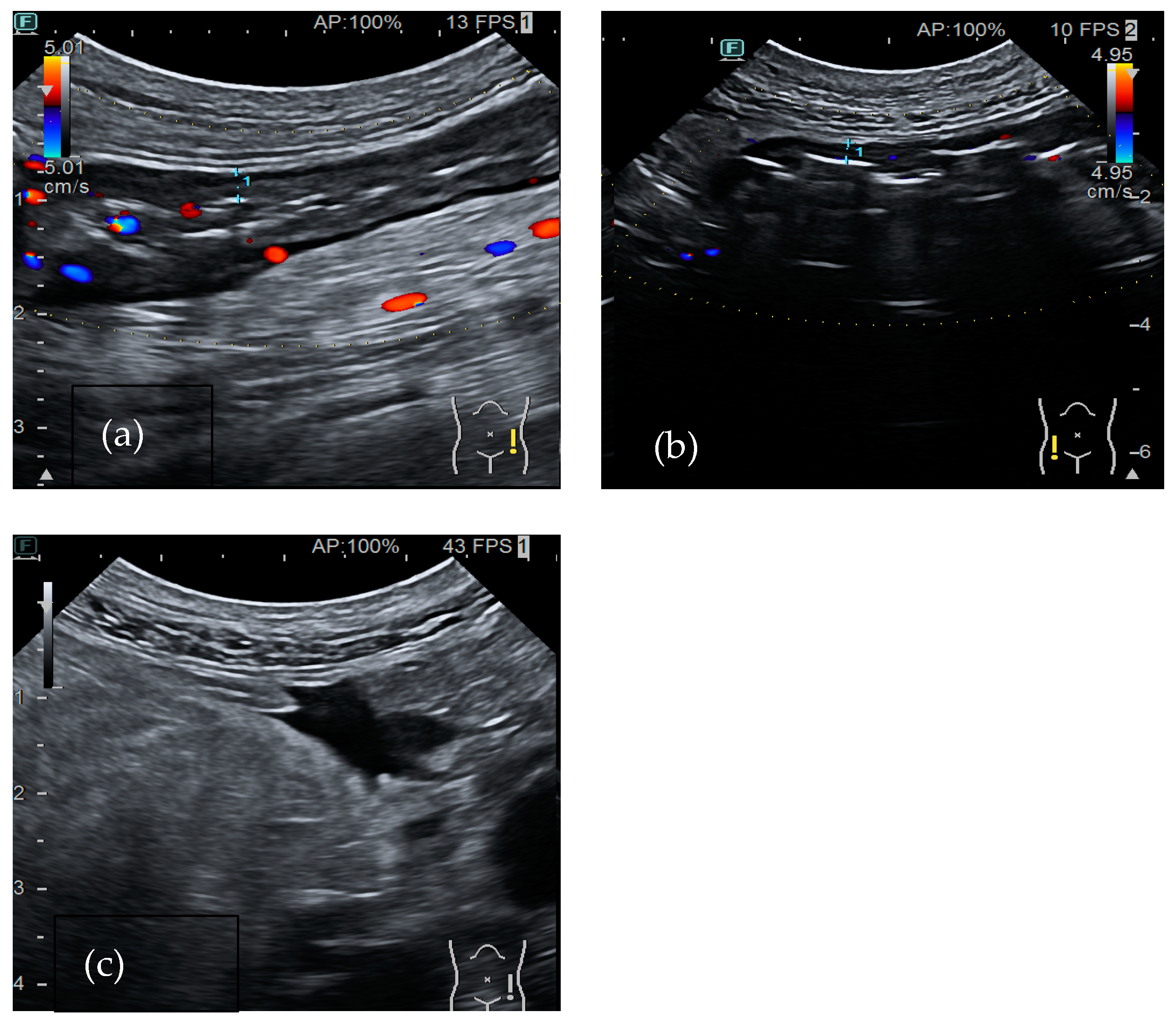 Medicina 60 01402 g003