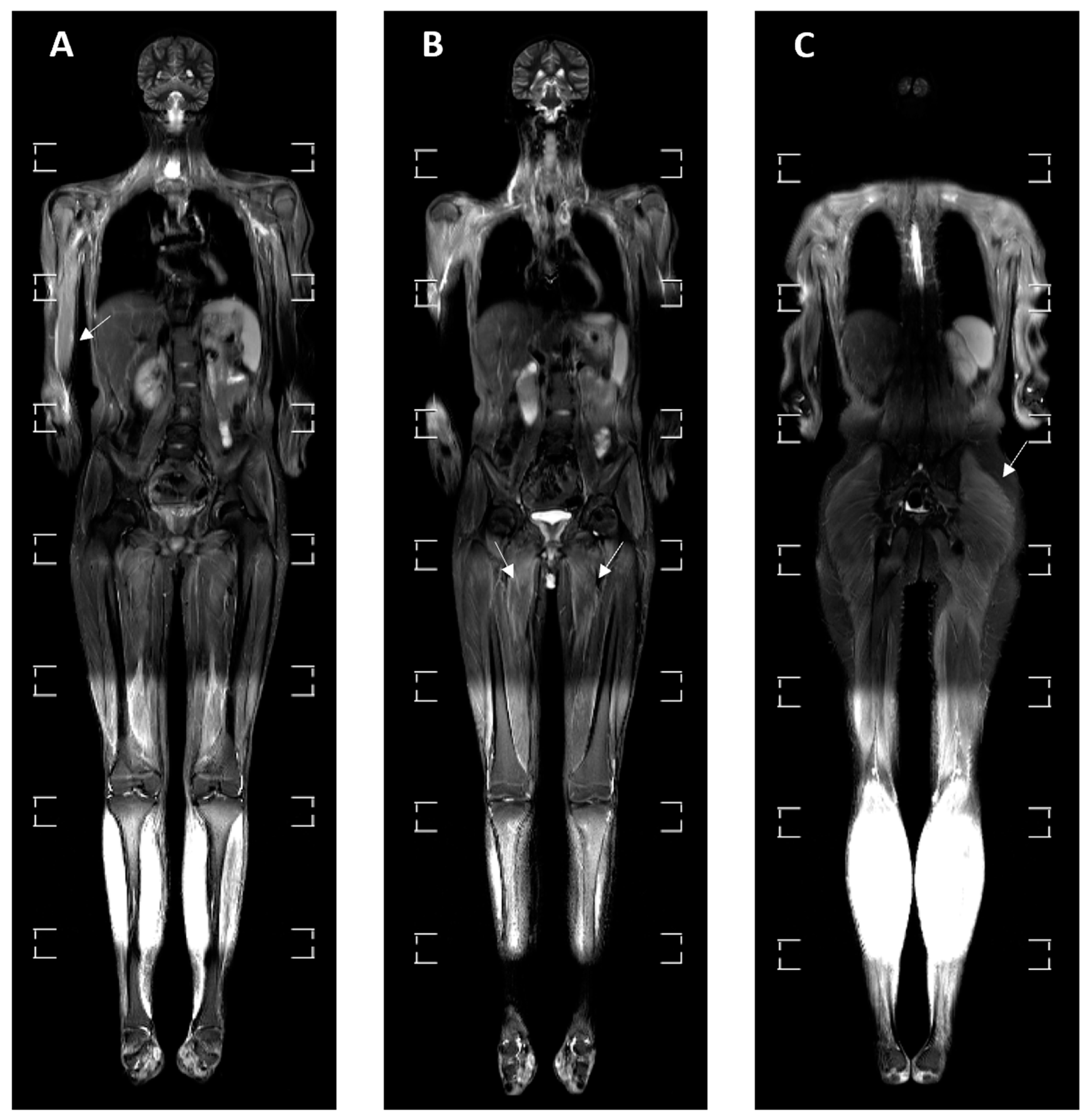Medicina 60 01407 g004