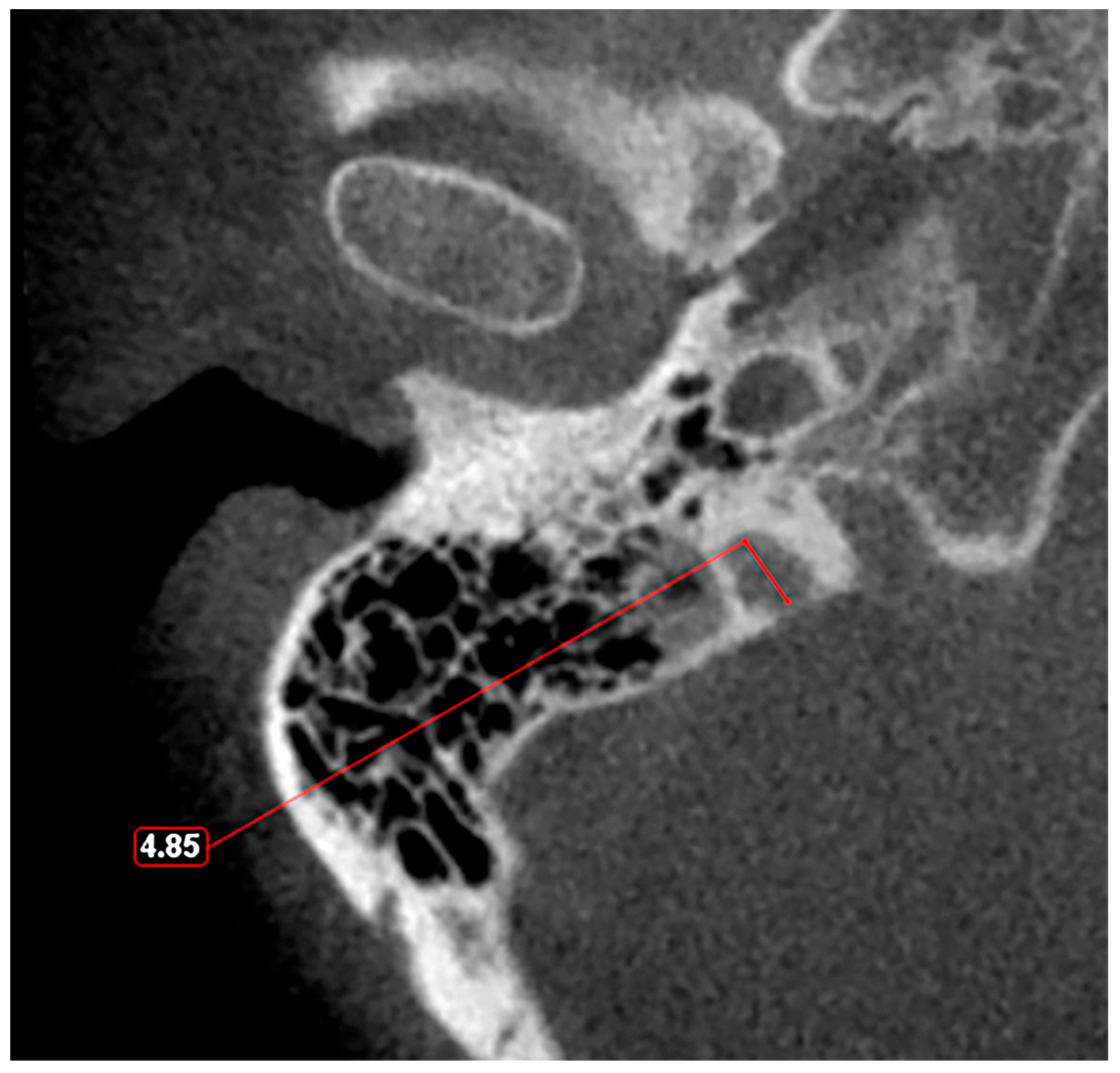 Medicina 60 01408 g003