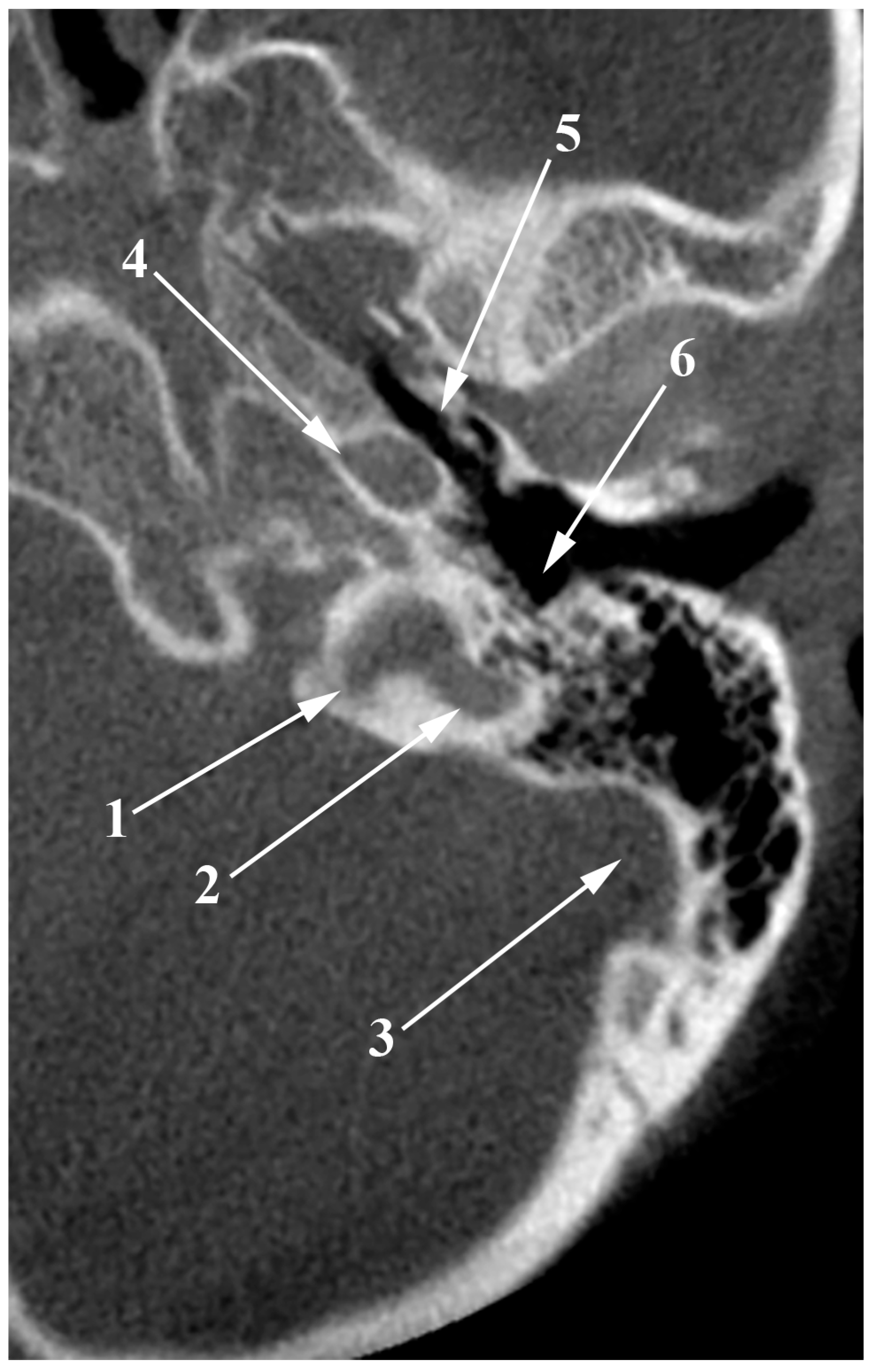 Medicina 60 01408 g006
