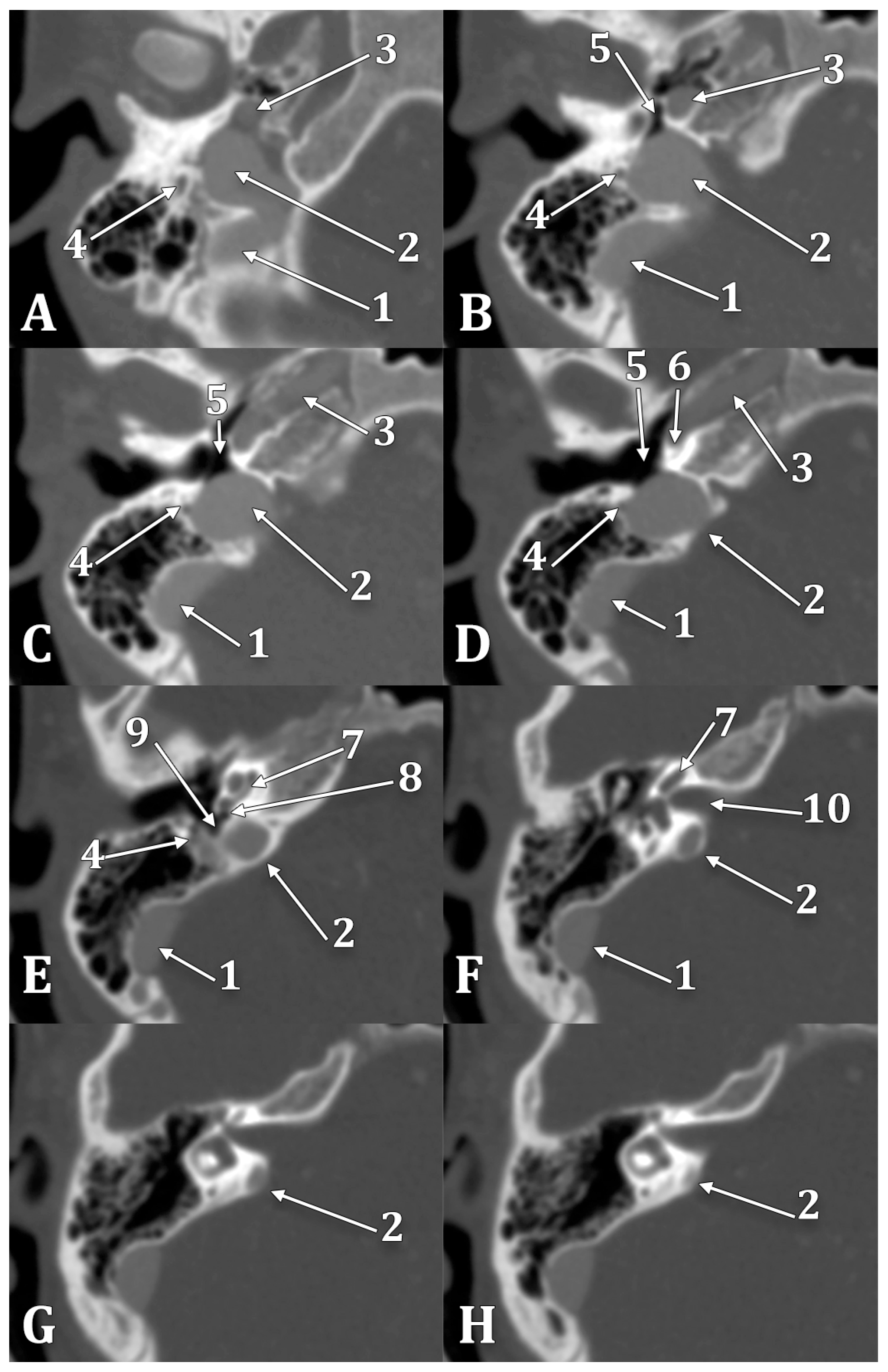 Medicina 60 01408 g008