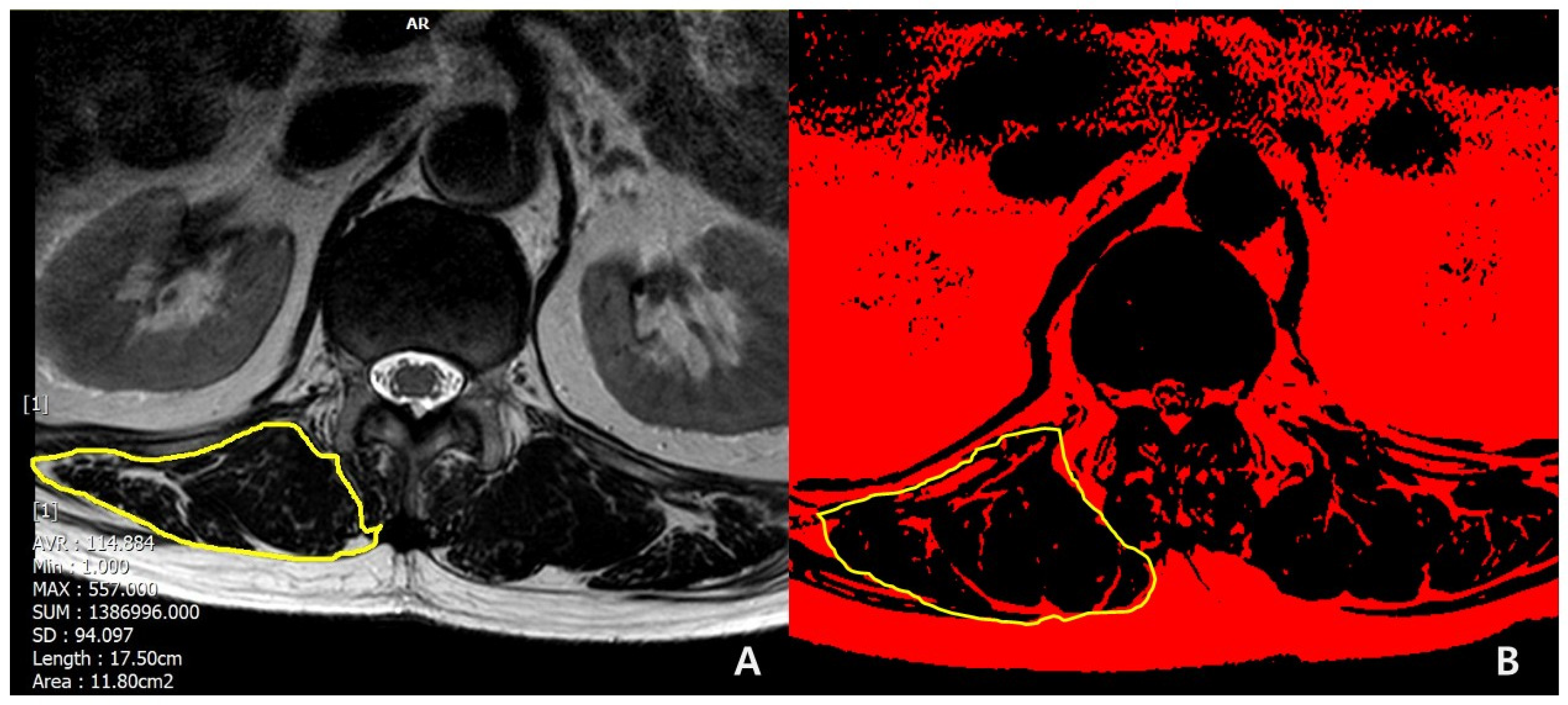 Medicina 60 01441 g002