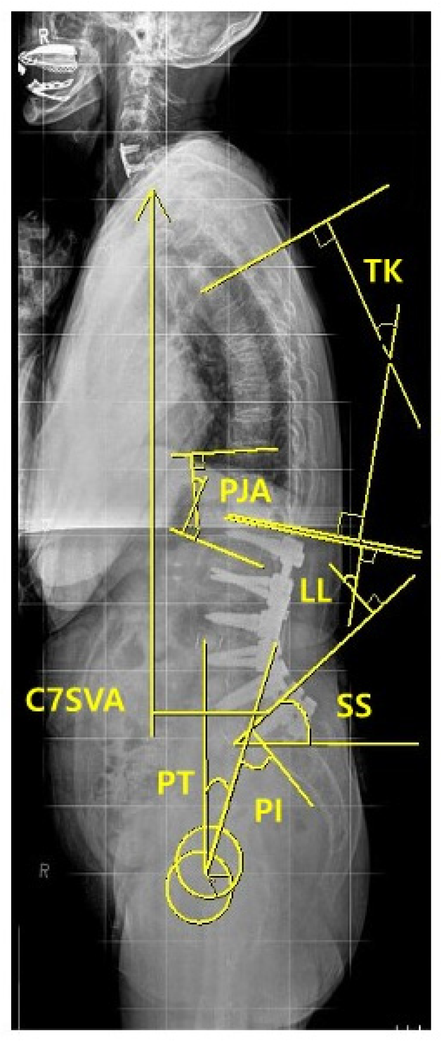 Medicina 60 01441 g003