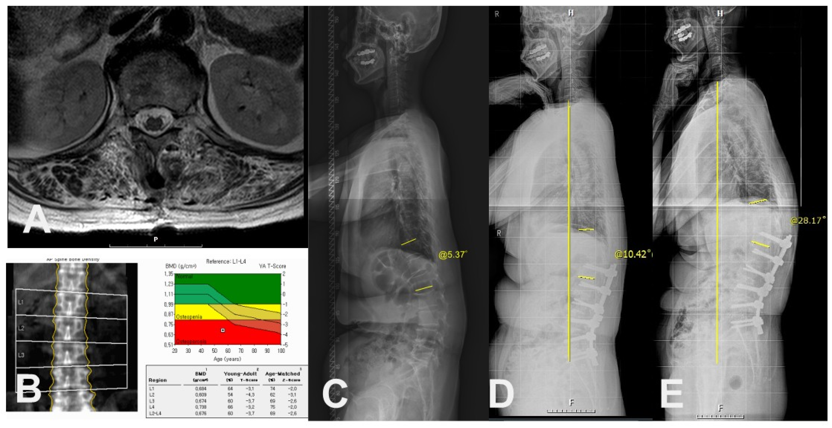 Medicina 60 01441 g004