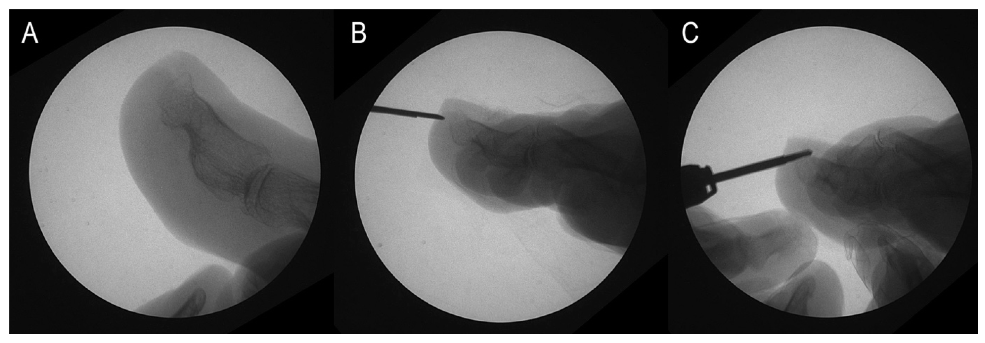 Medicina 60 01447 g002