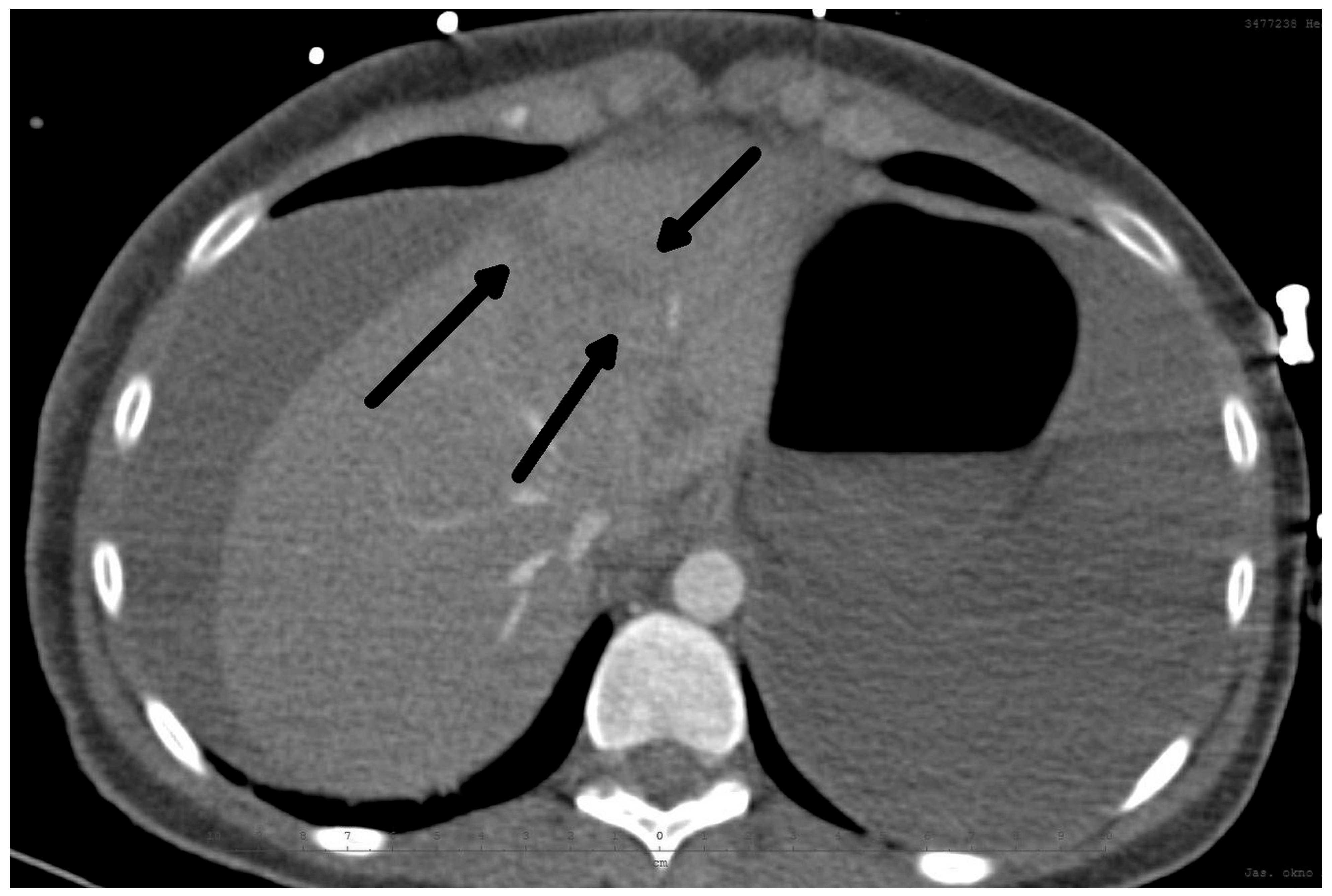 Medicina 60 01470 g001 Medicina 60 01470 g001
