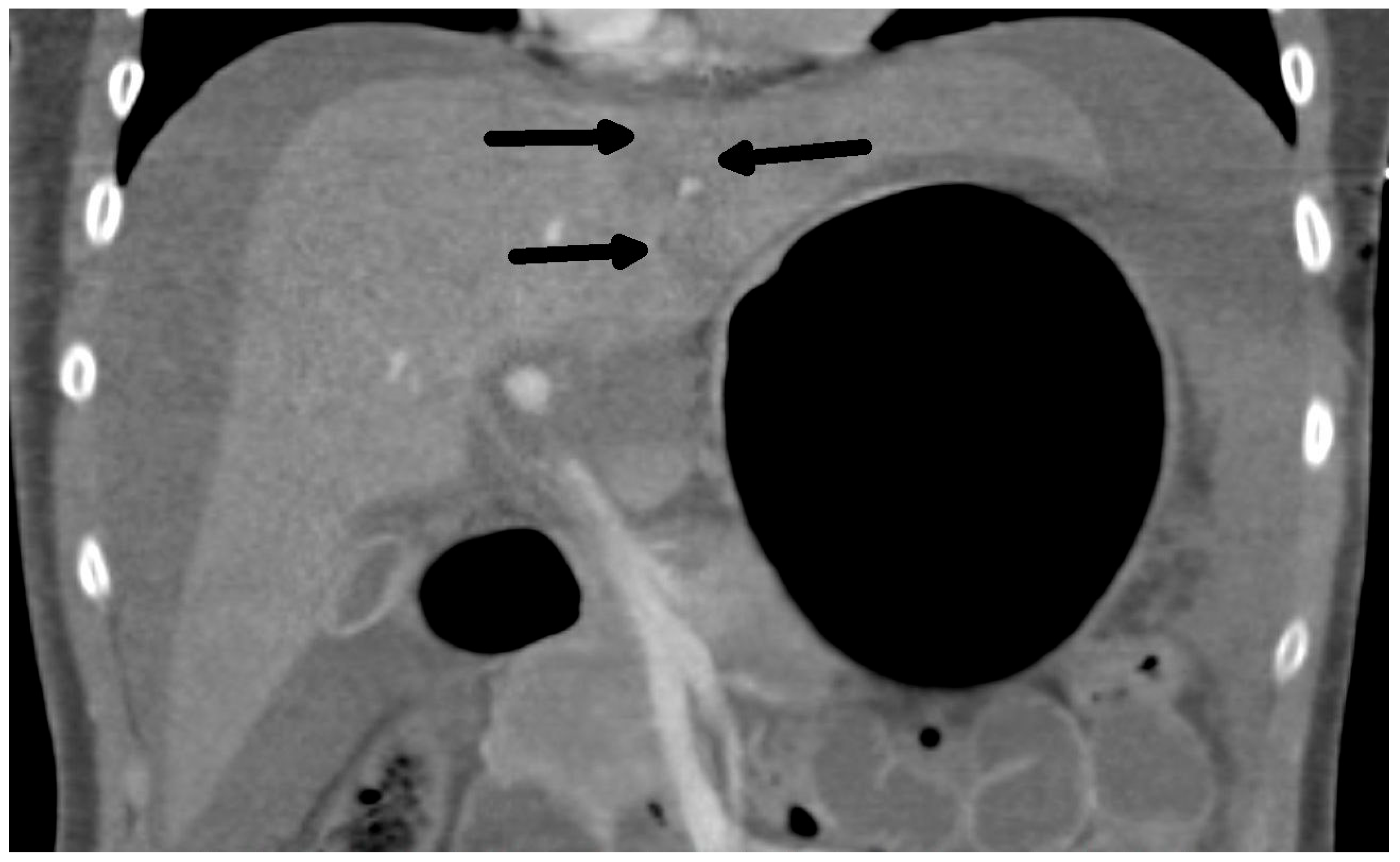 Medicina 60 01470 g002 Medicina 60 01470 g002