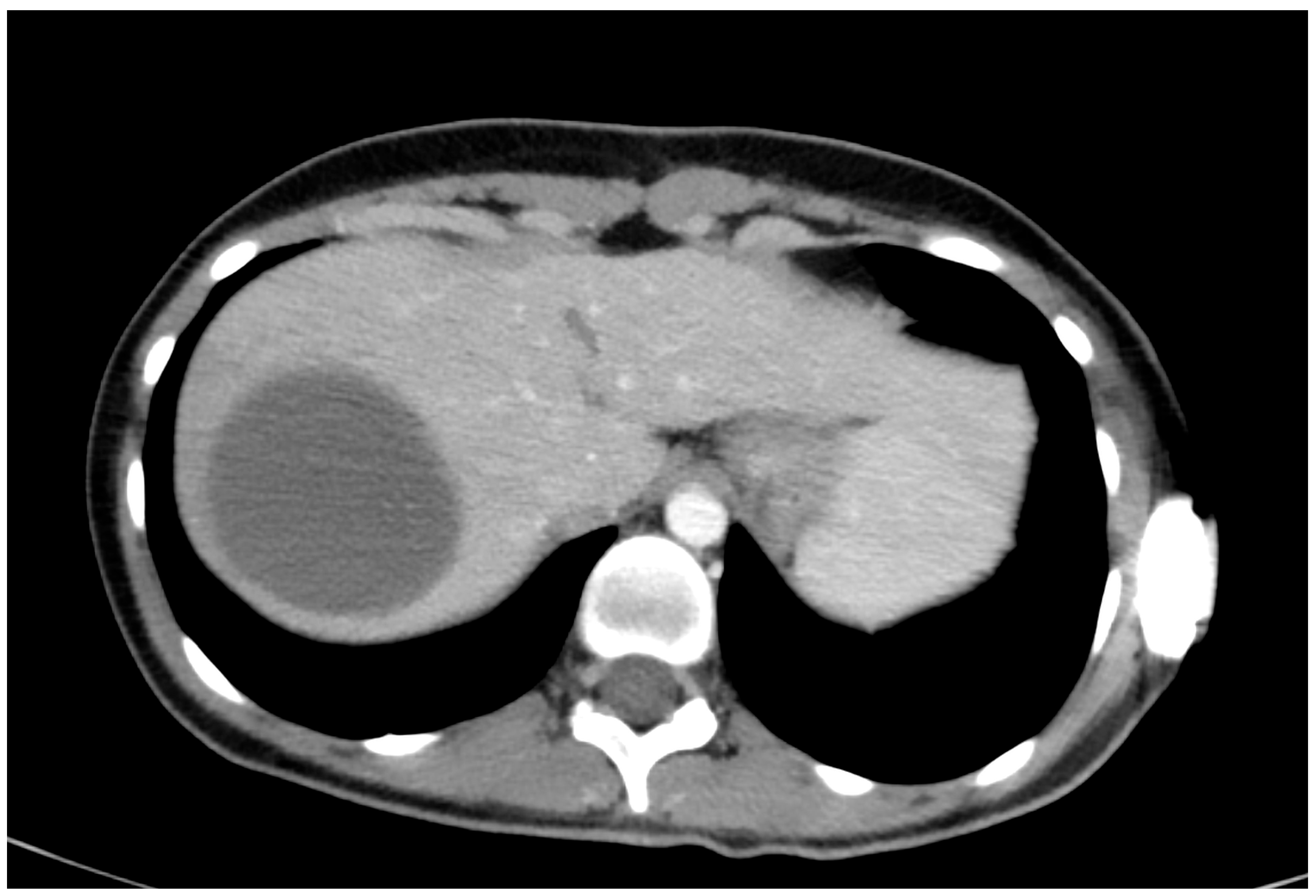 Medicina 60 01470 g003 Medicina 60 01470 g003