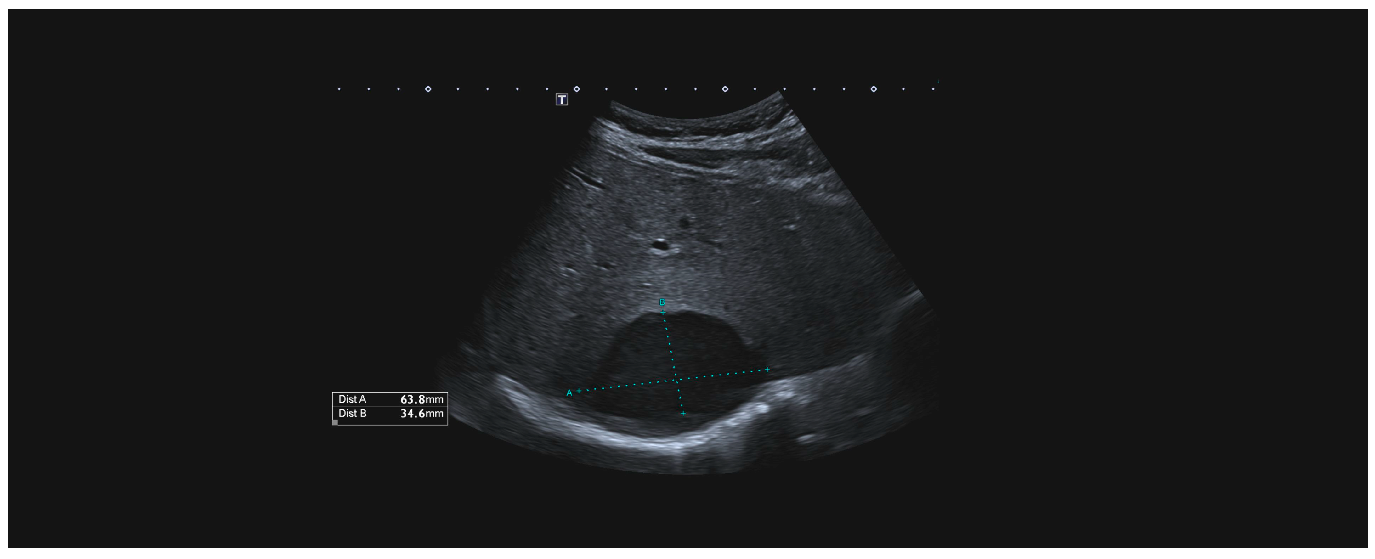 Medicina 60 01470 g004 Medicina 60 01470 g004