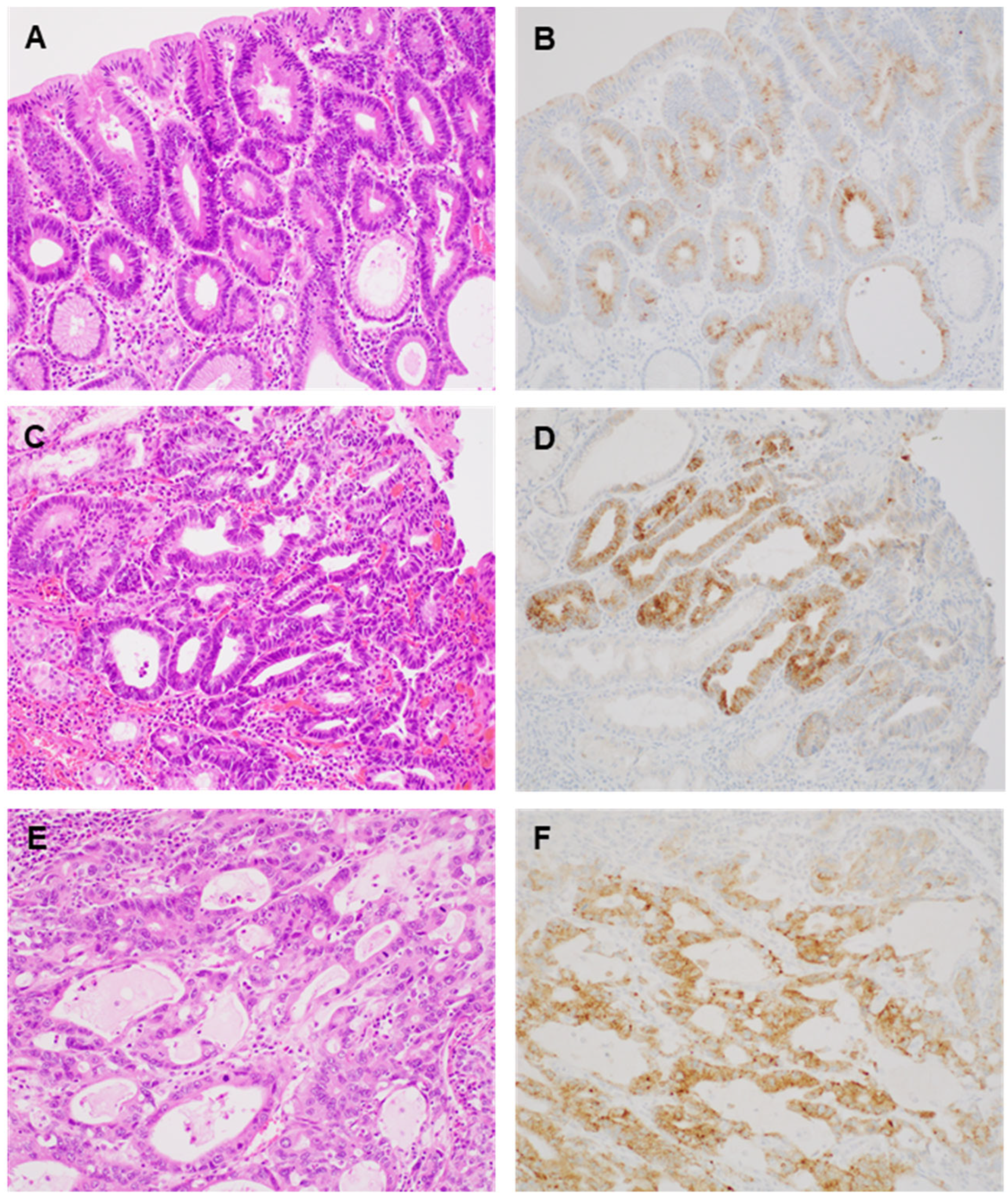 Medicina 60 01475 g001