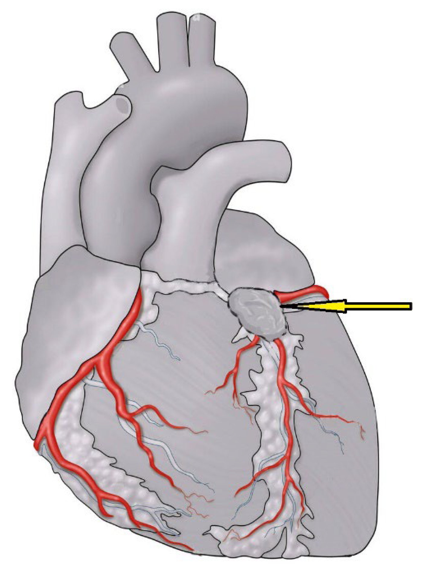 Medicina 60 01495 g001