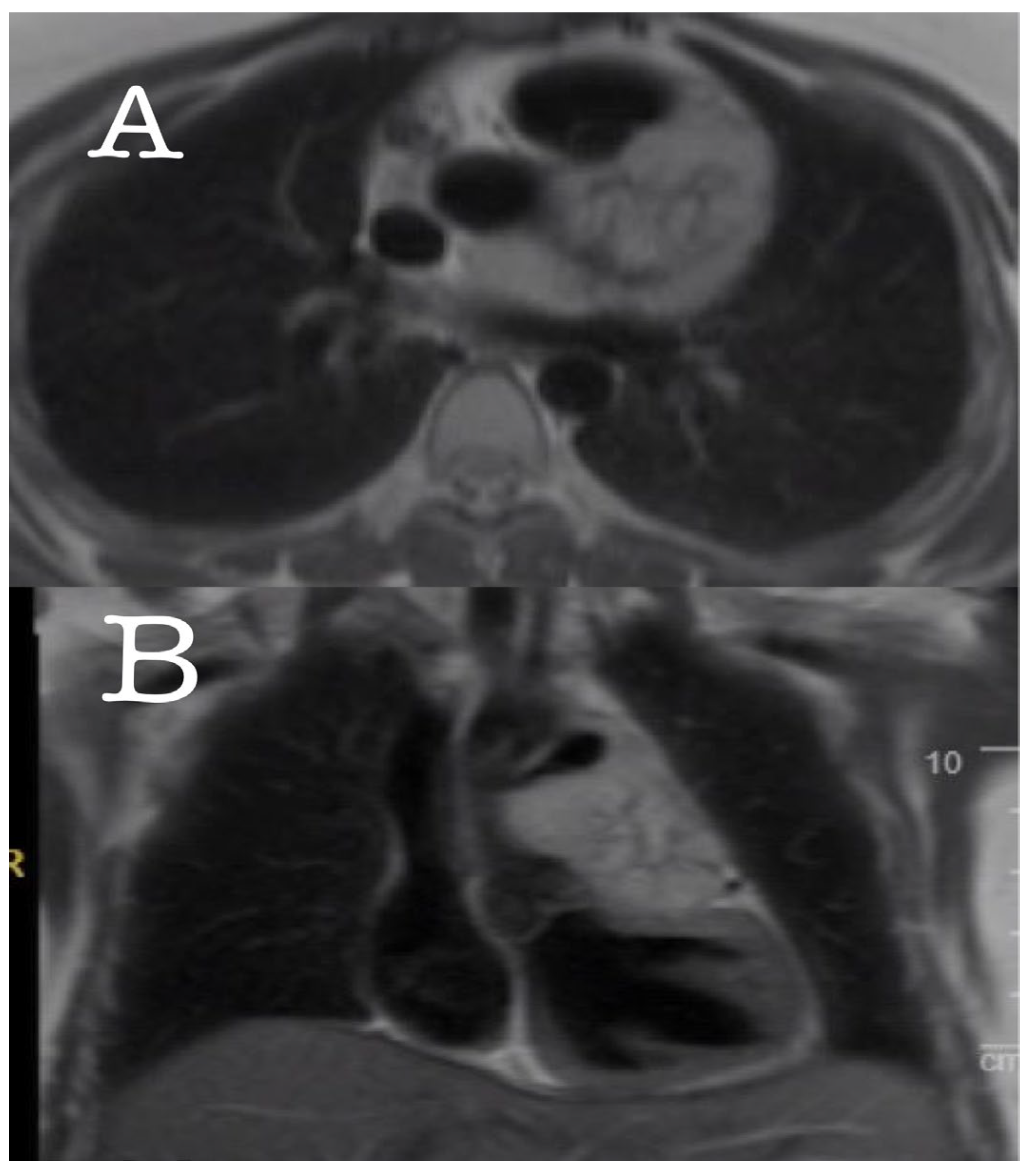 Medicina 60 01495 g002