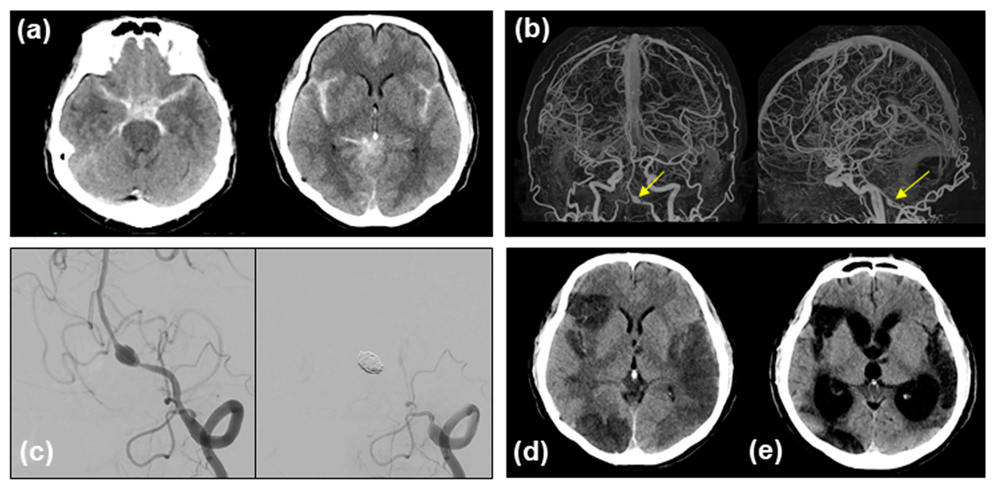 Medicina 60 01543 g001