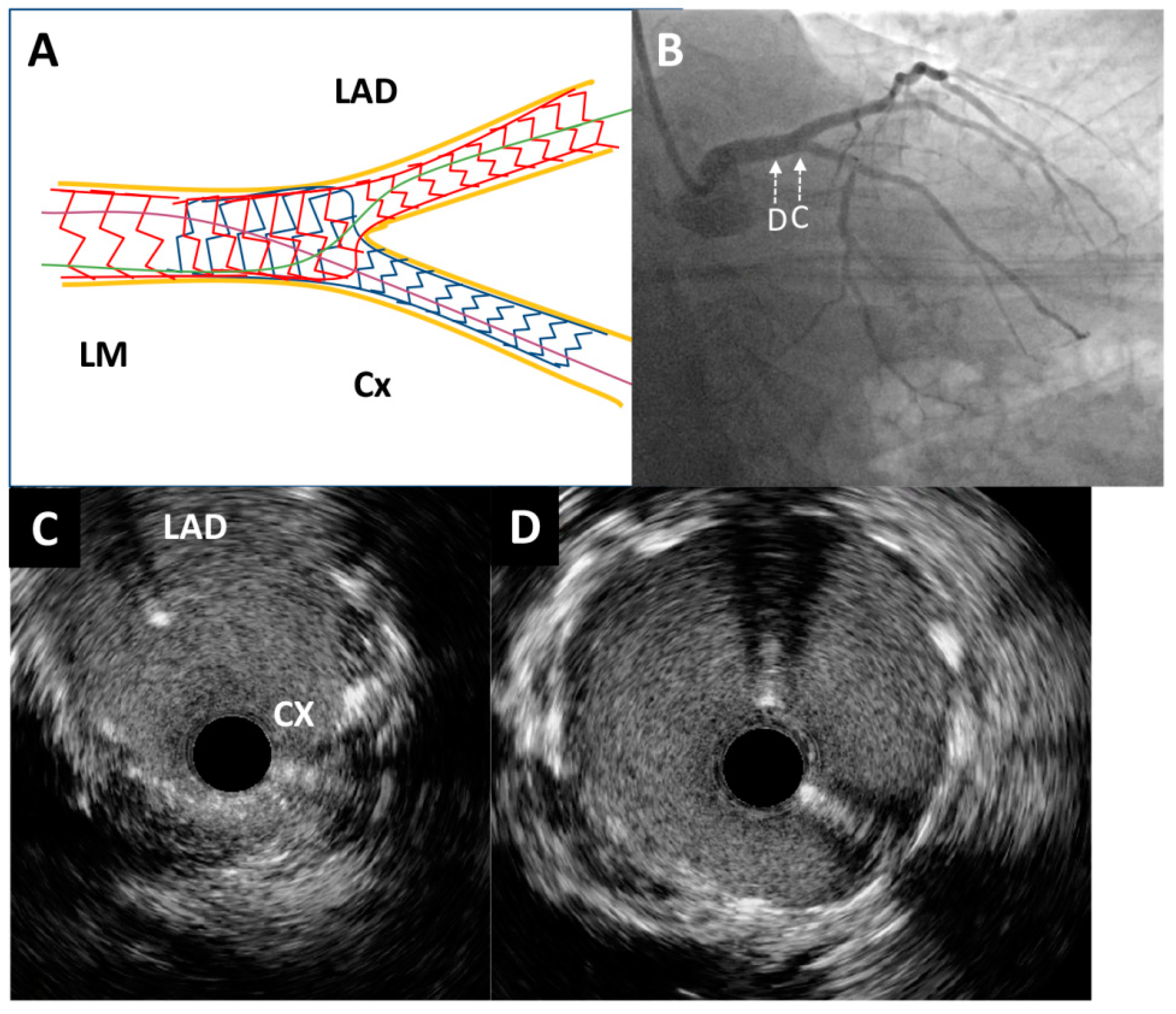 Medicina 60 01563 g004
