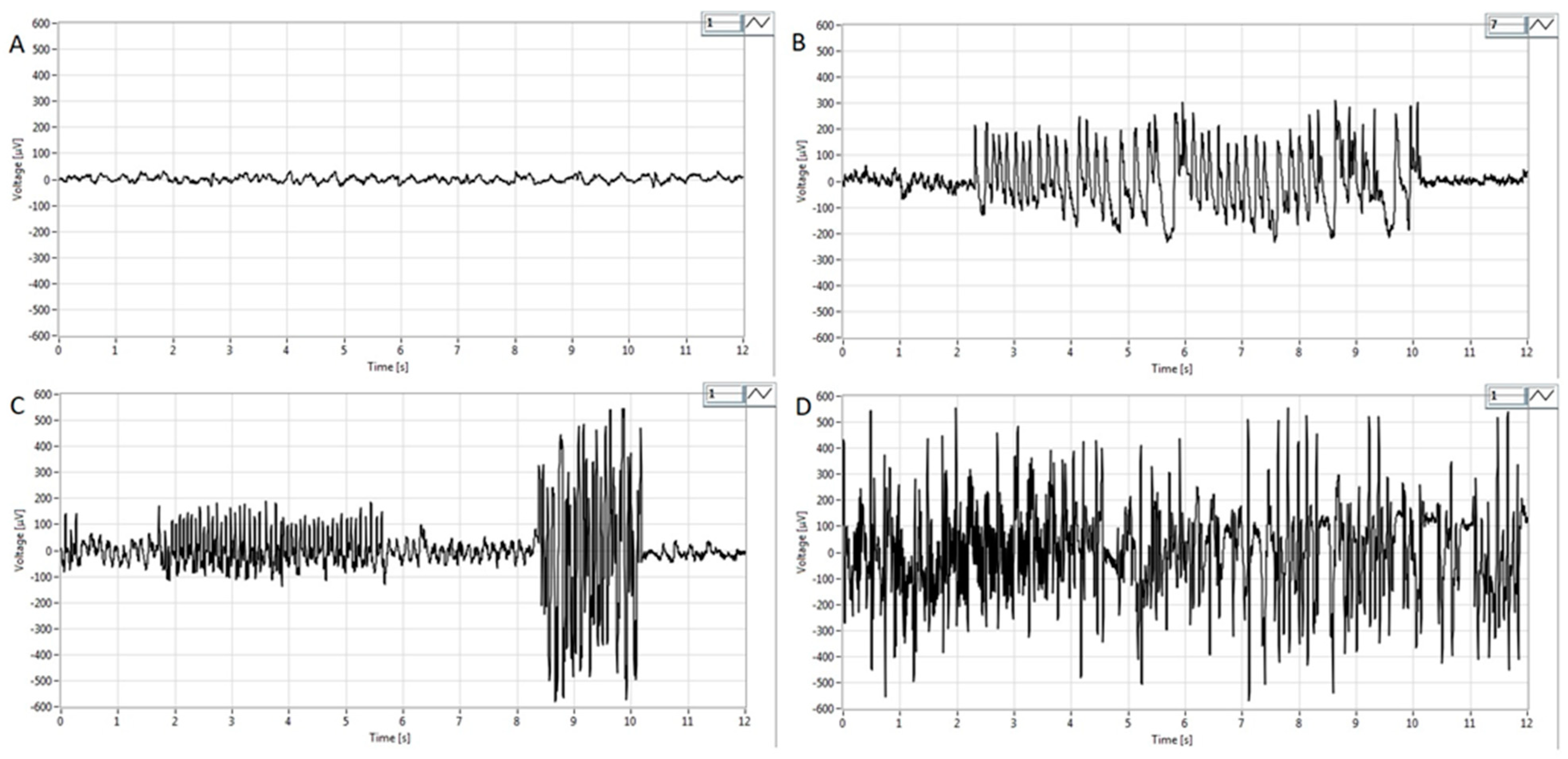 Medicina 60 01579 g004
