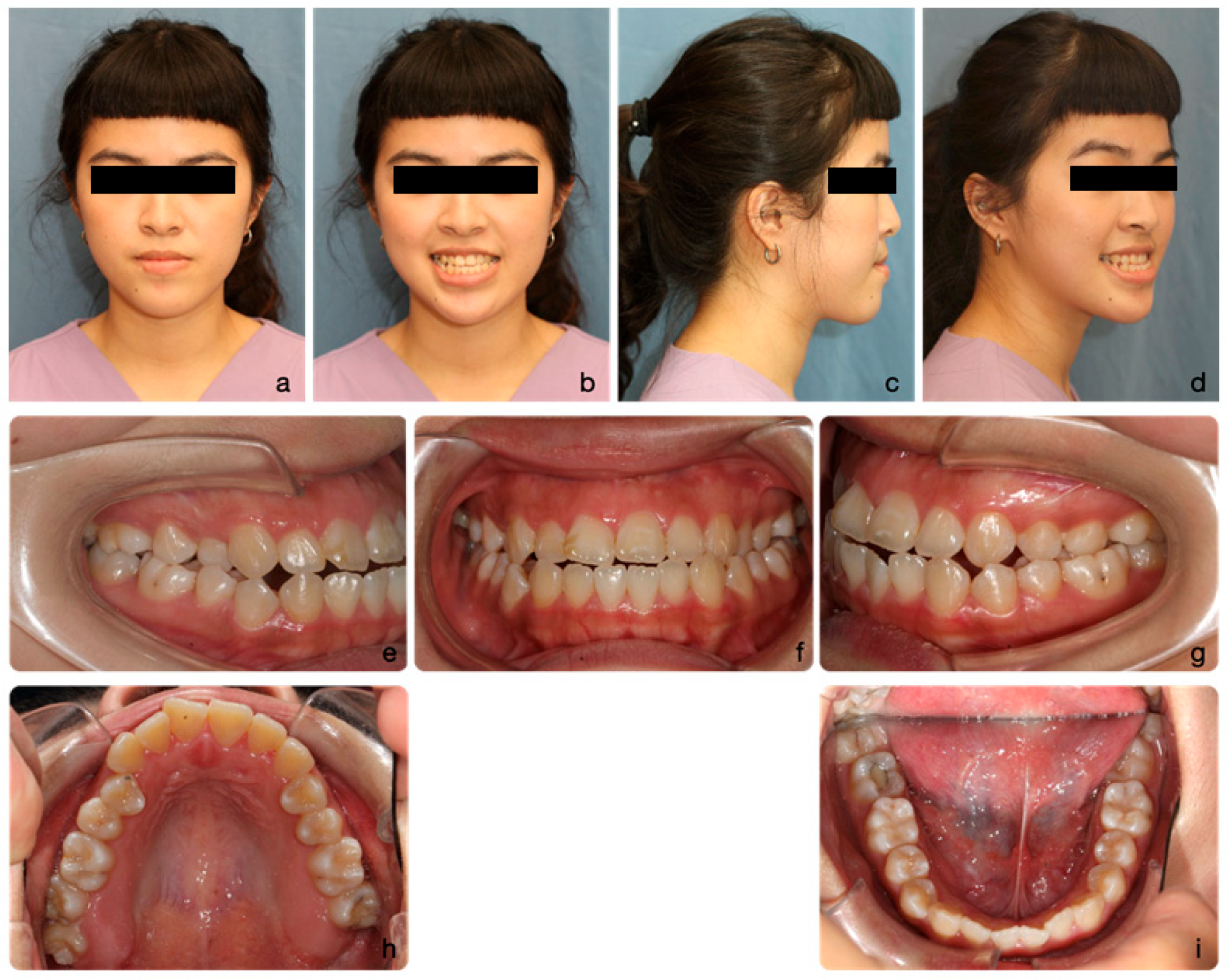 Medicina 60 01588 g001