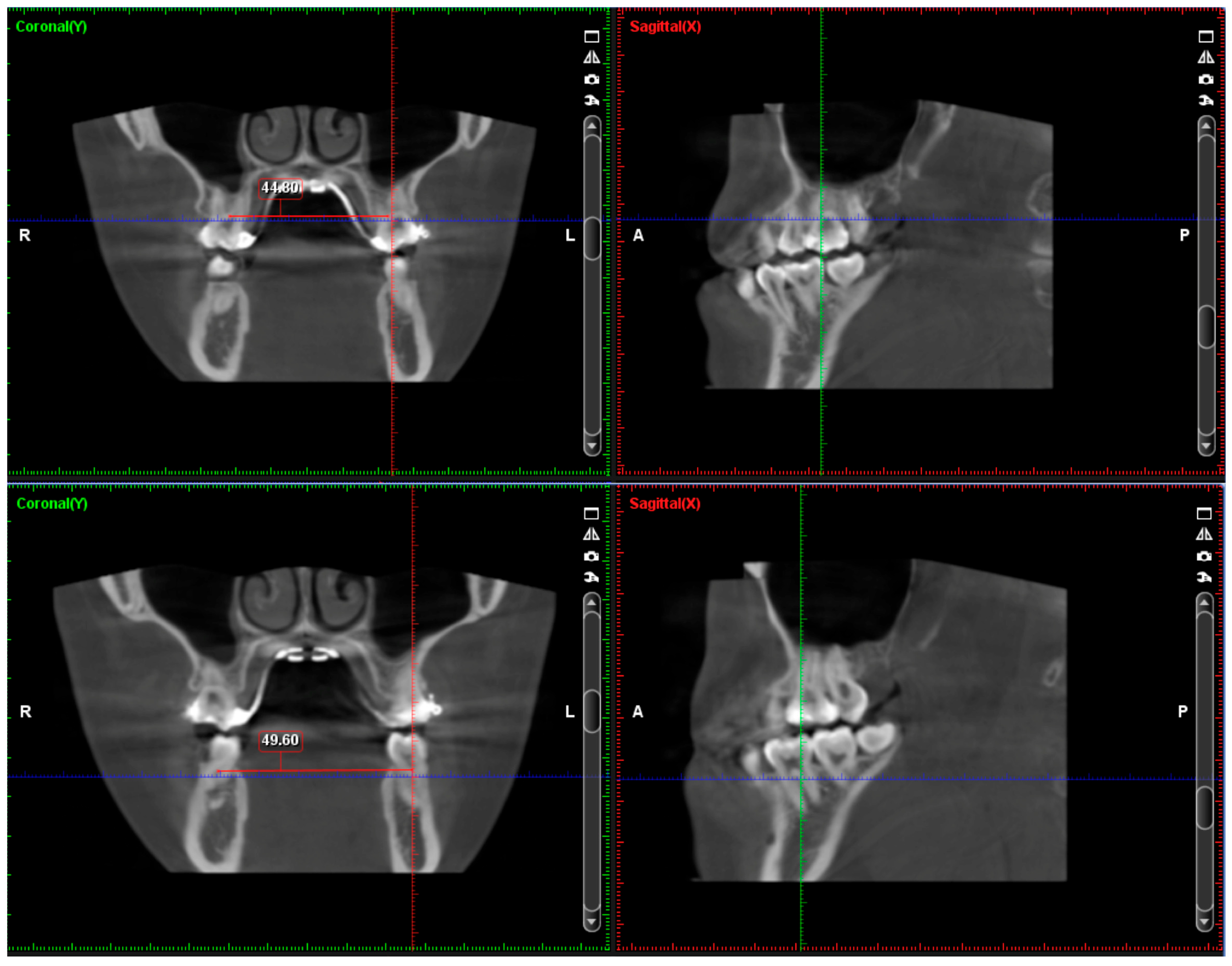 Medicina 60 01588 g004