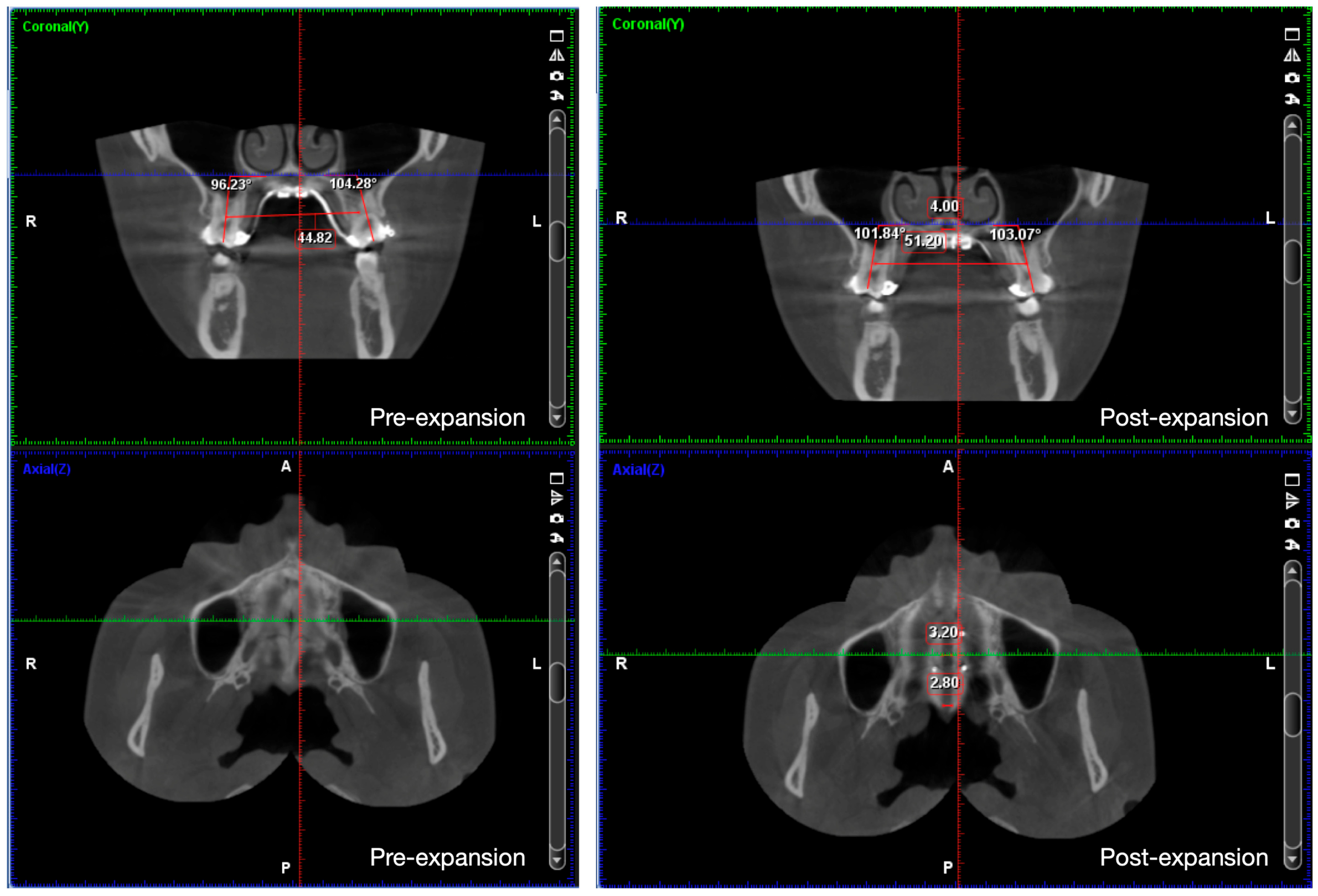 Medicina 60 01588 g005