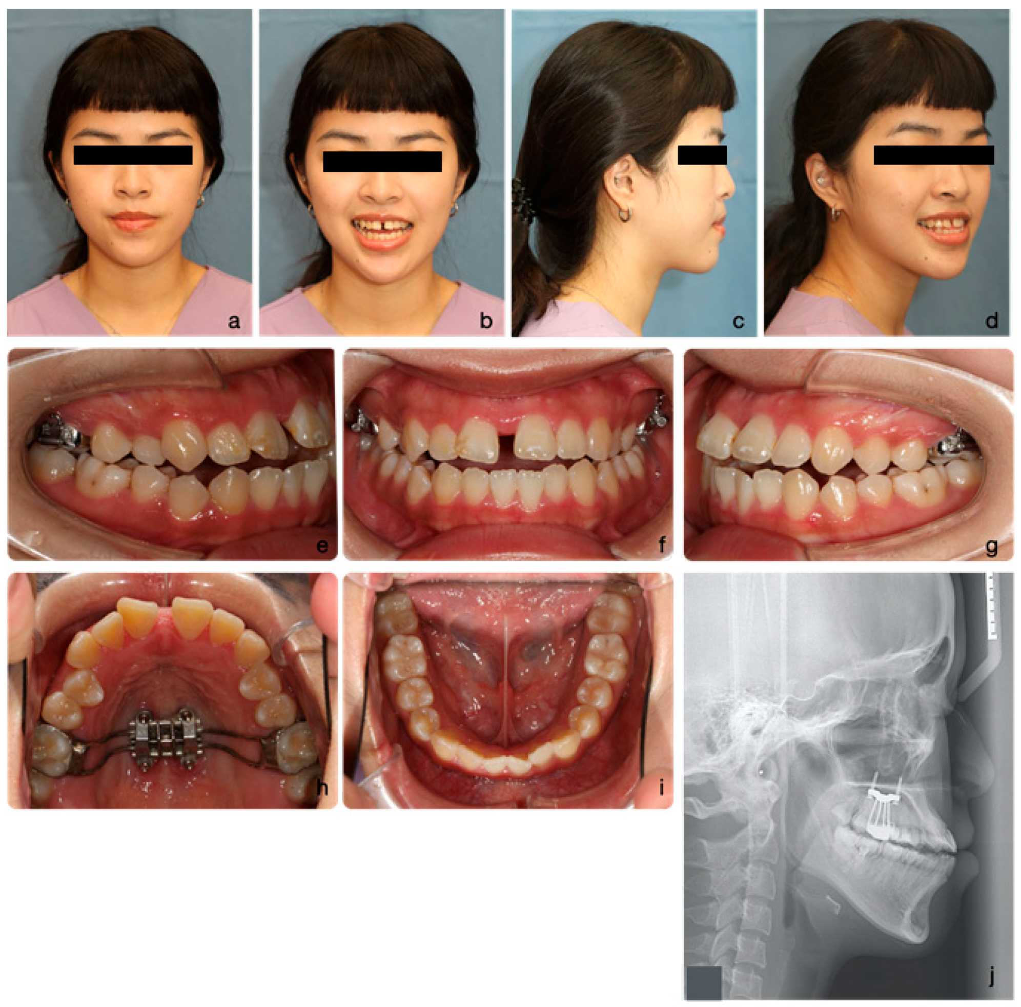 Medicina 60 01588 g006