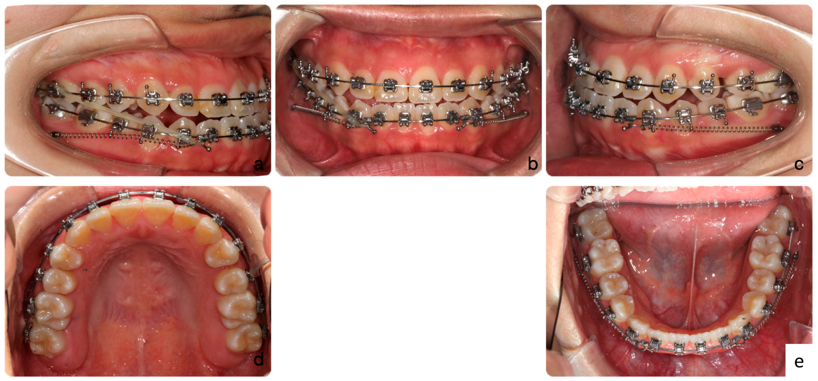 Medicina 60 01588 g007