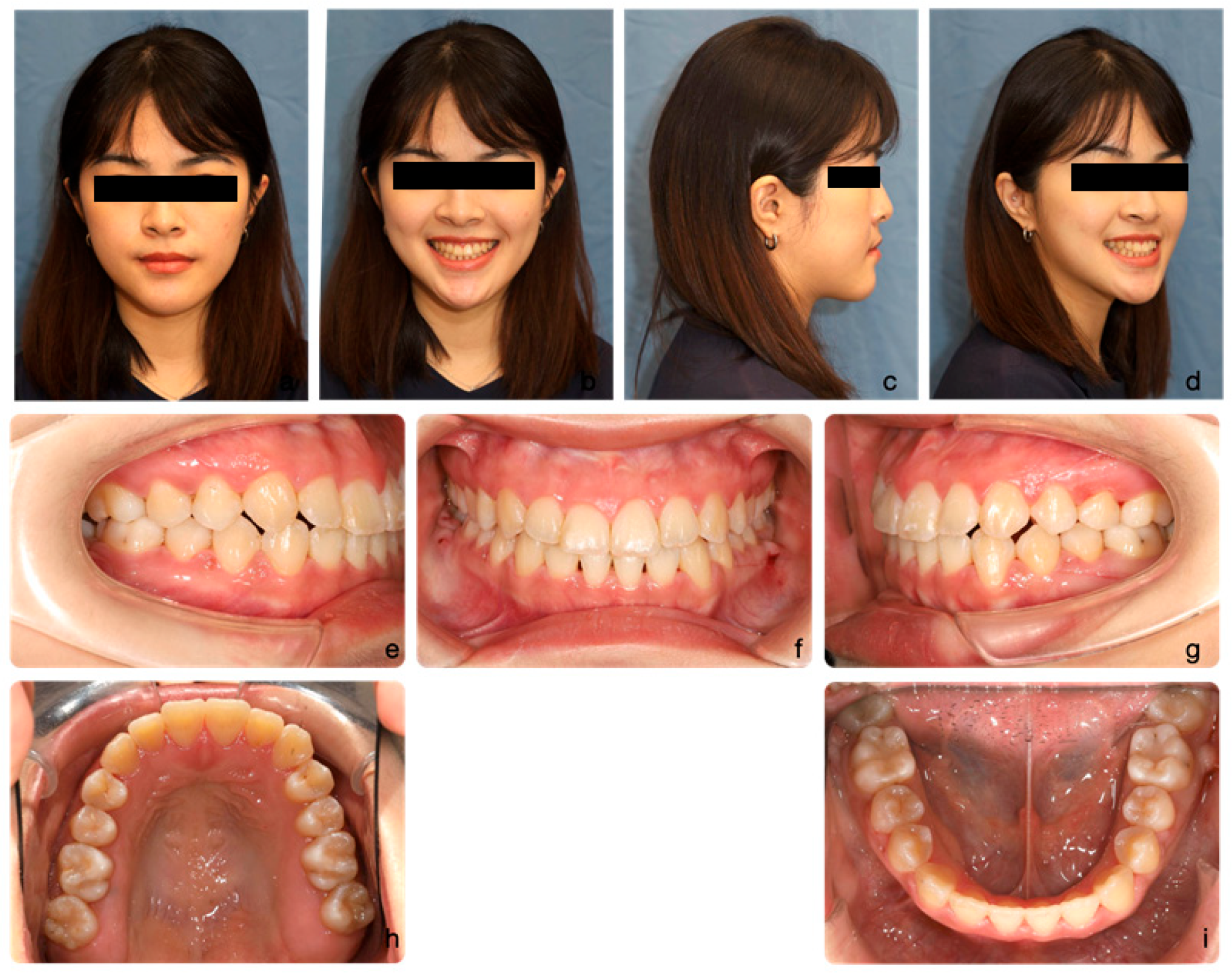 Medicina 60 01588 g009