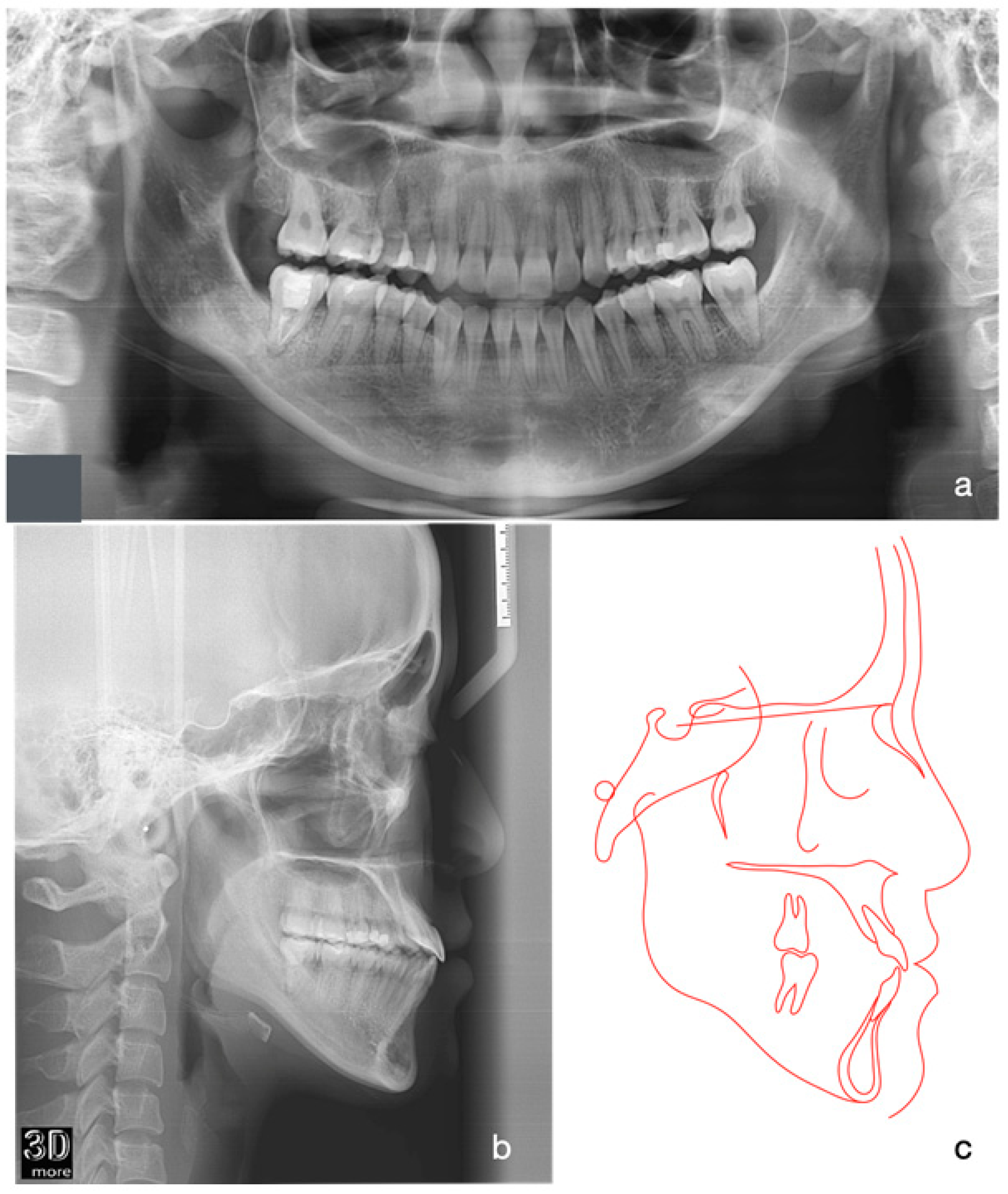 Medicina 60 01588 g010
