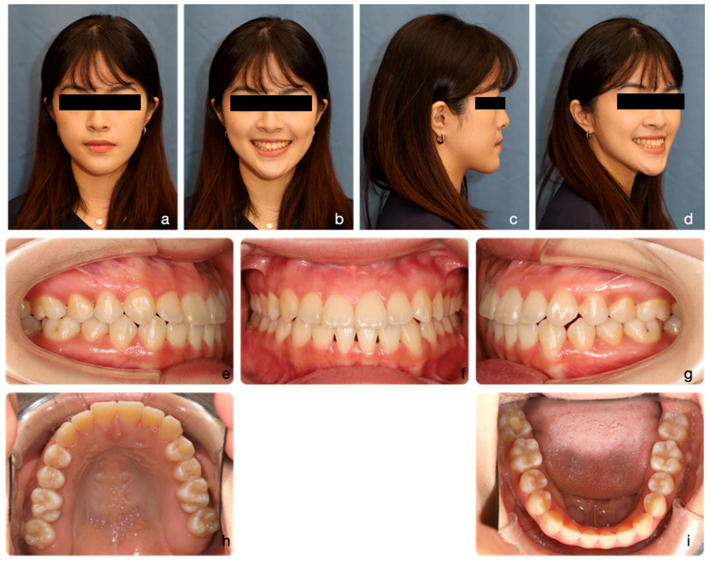 Medicina 60 01588 g011