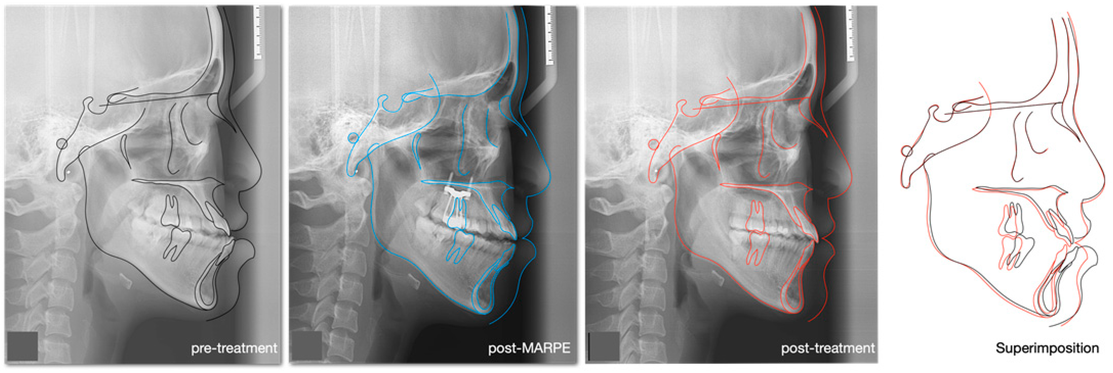 Medicina 60 01588 g012