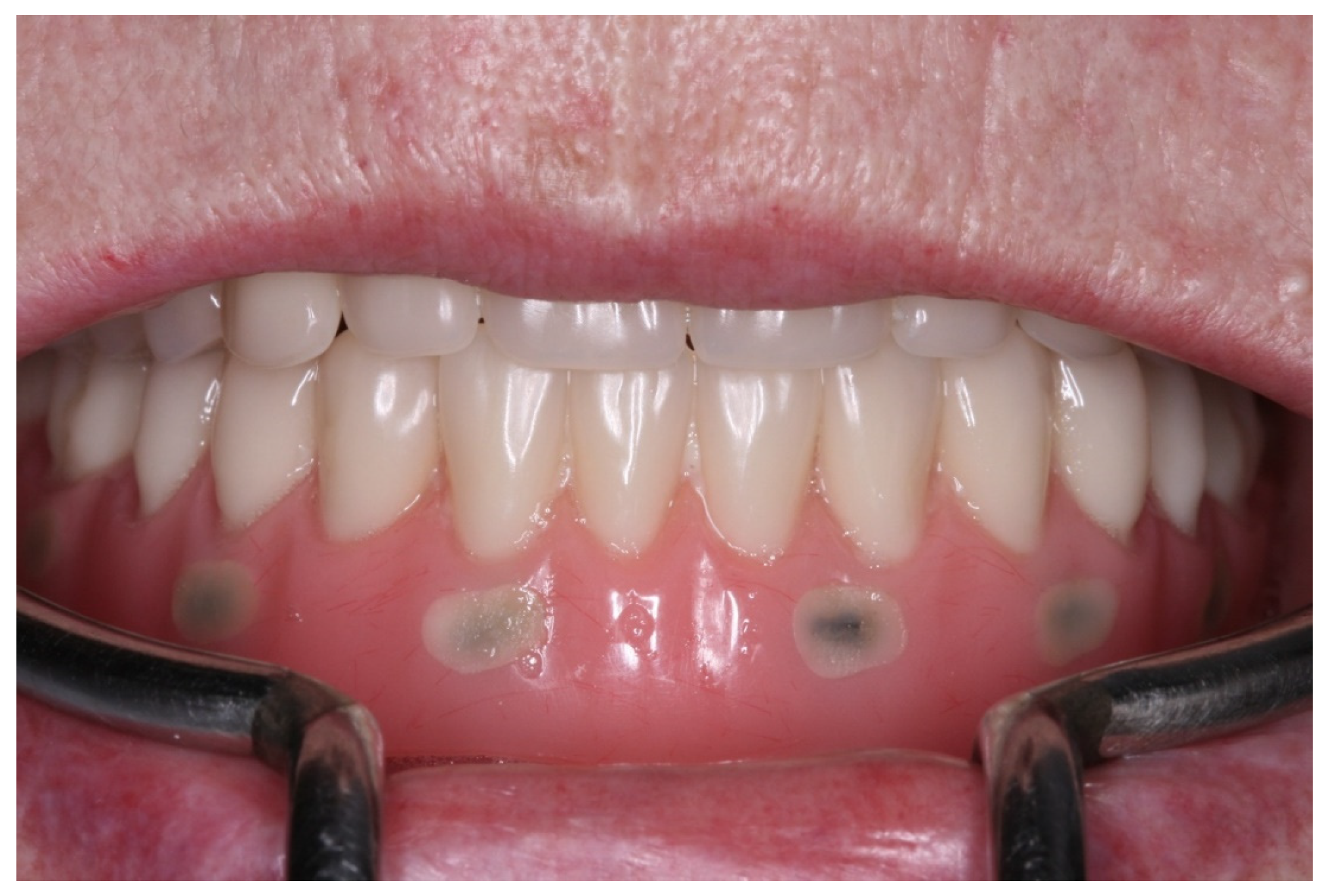 Medicina 60 01614 g002