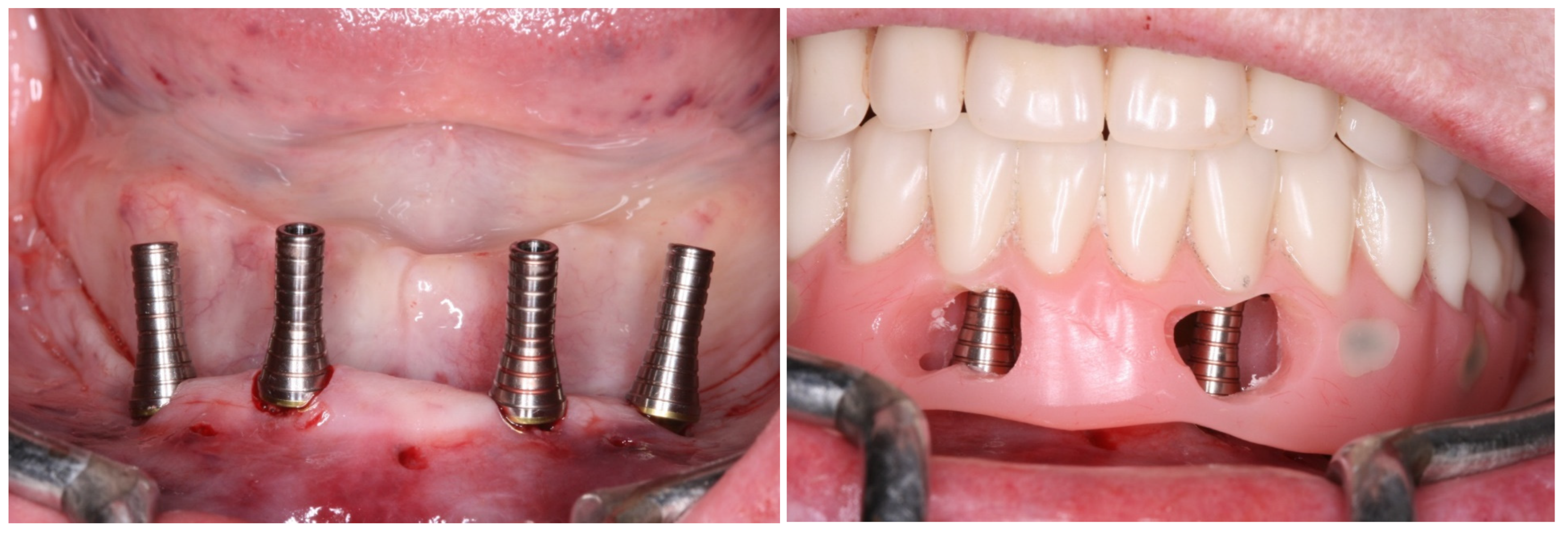 Medicina 60 01614 g008