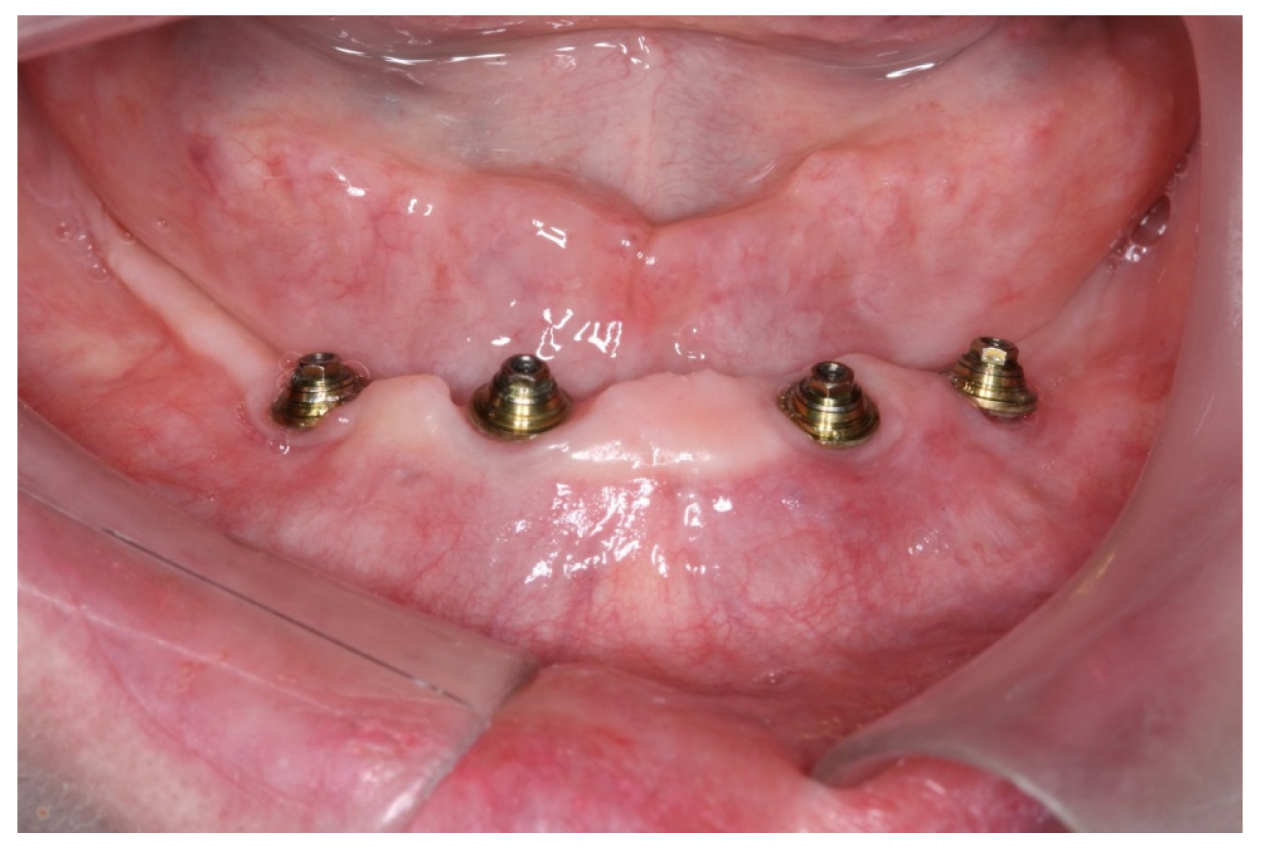 Medicina 60 01614 g010