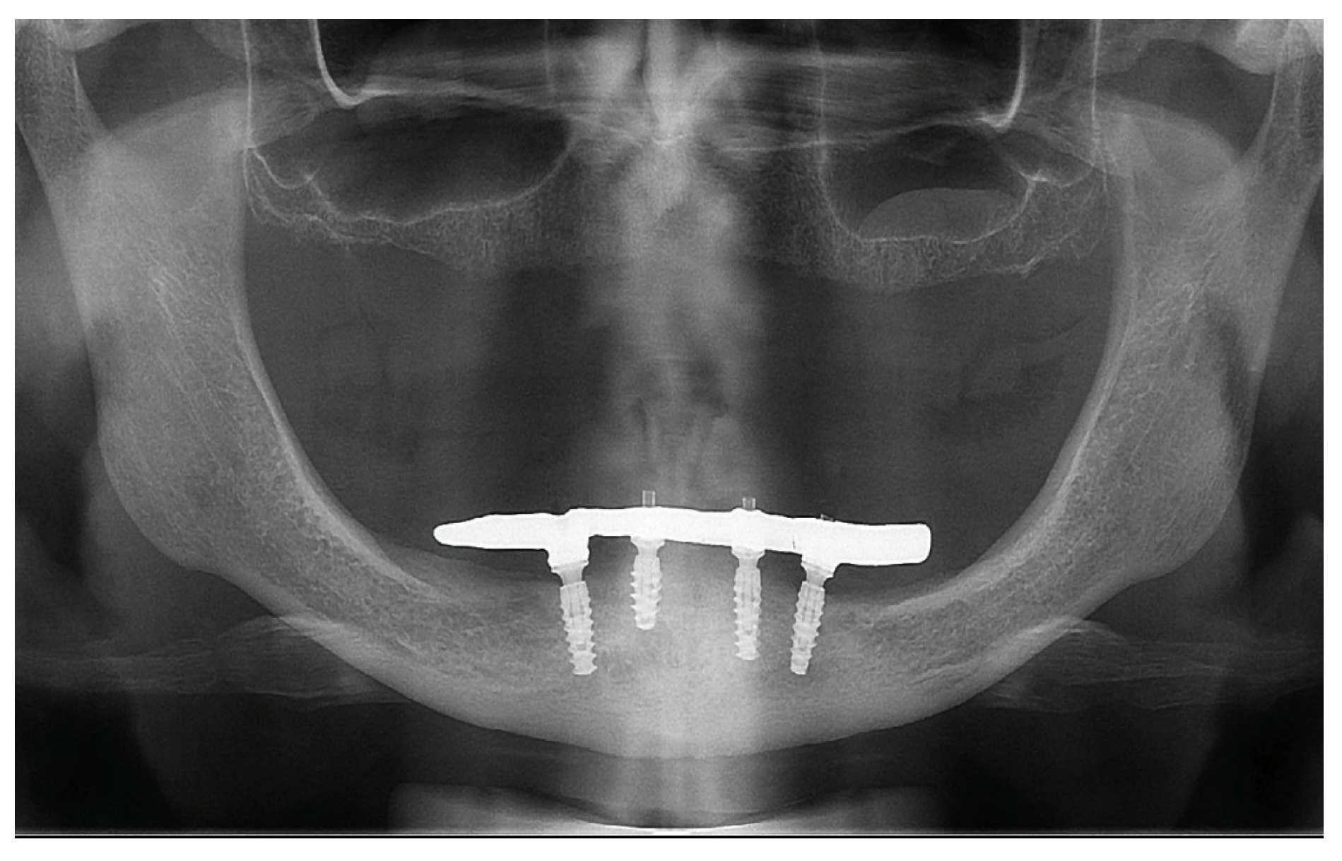 Medicina 60 01614 g012