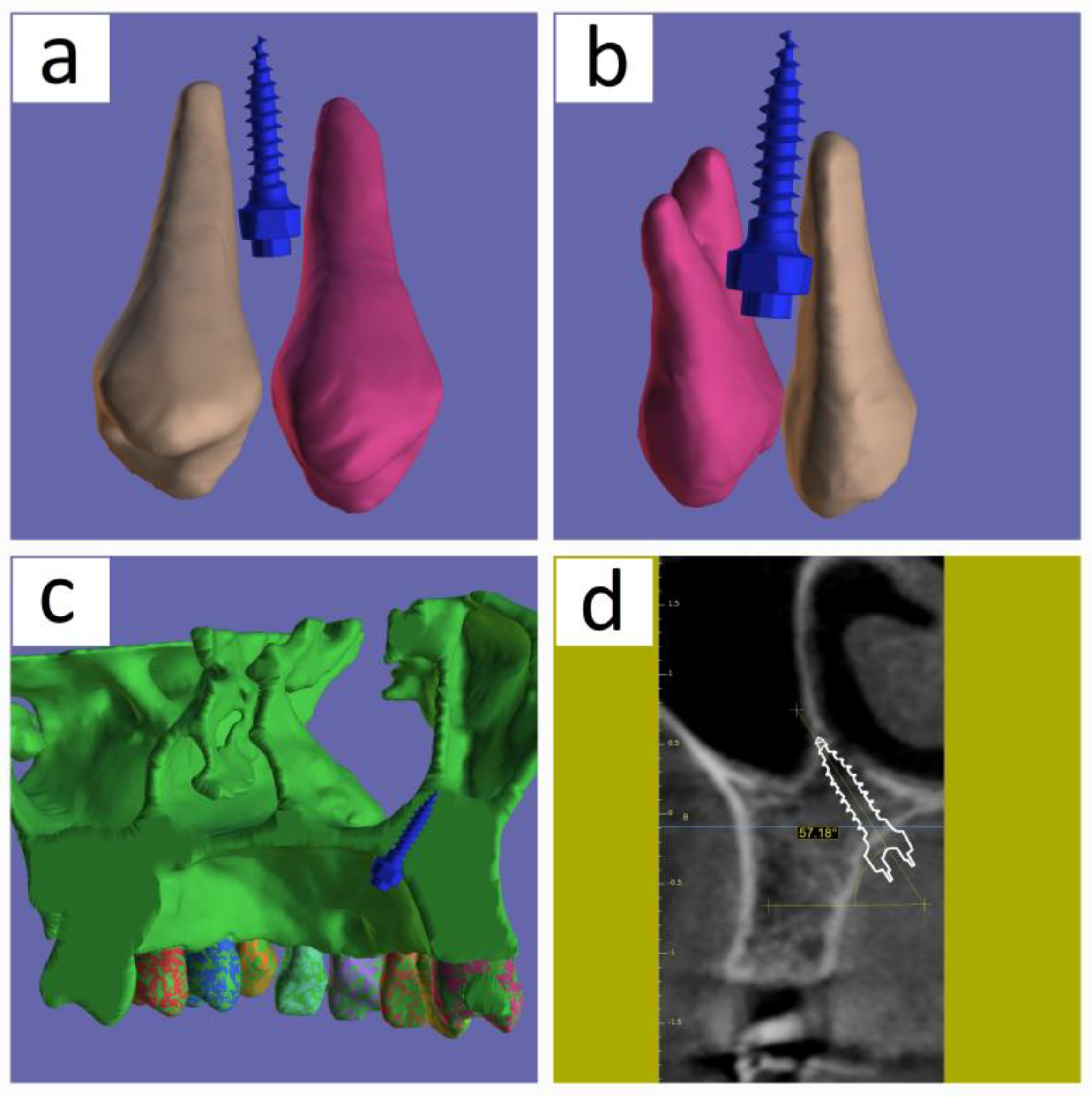 Medicina 60 01660 g004