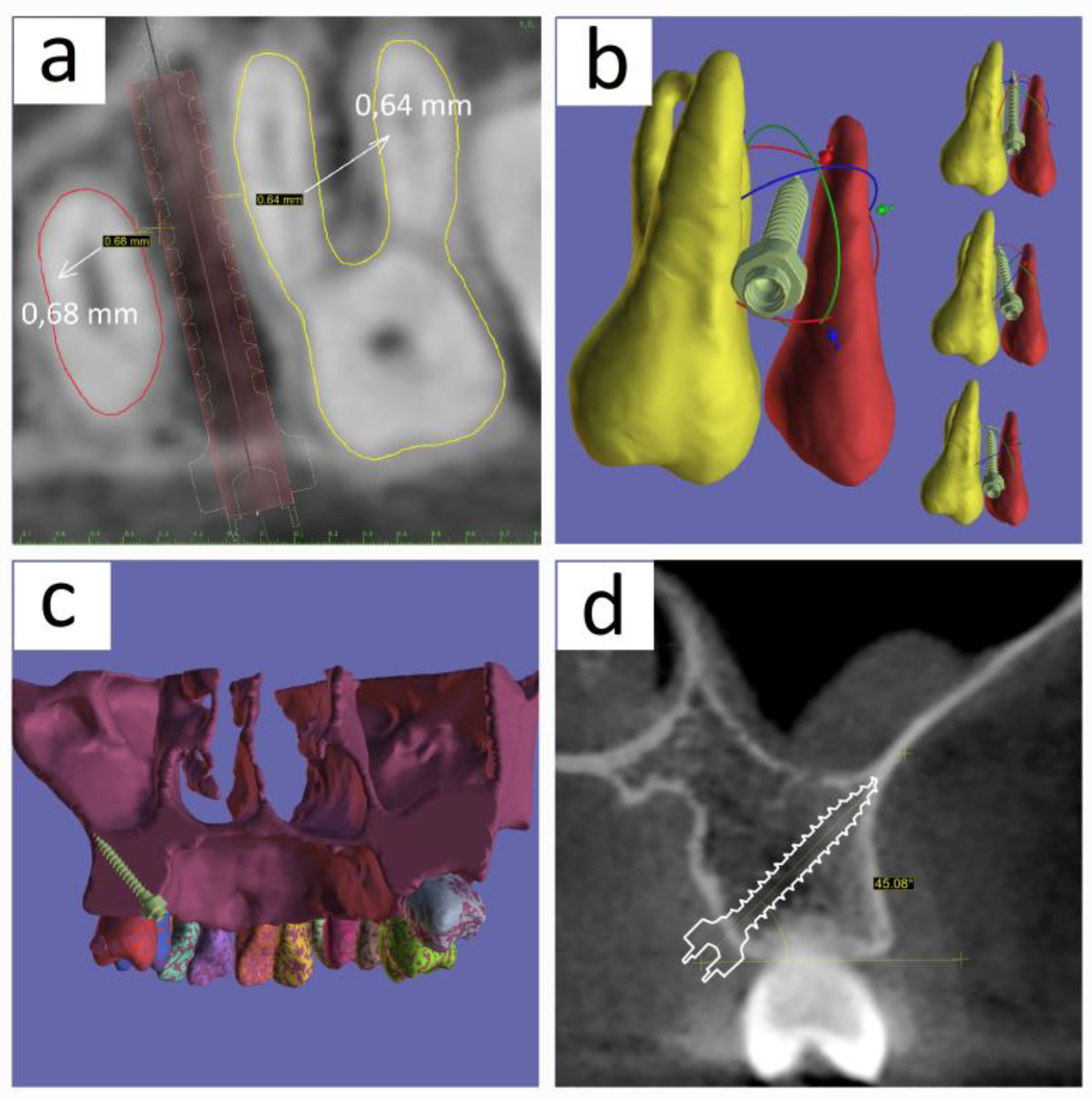 Medicina 60 01660 g005