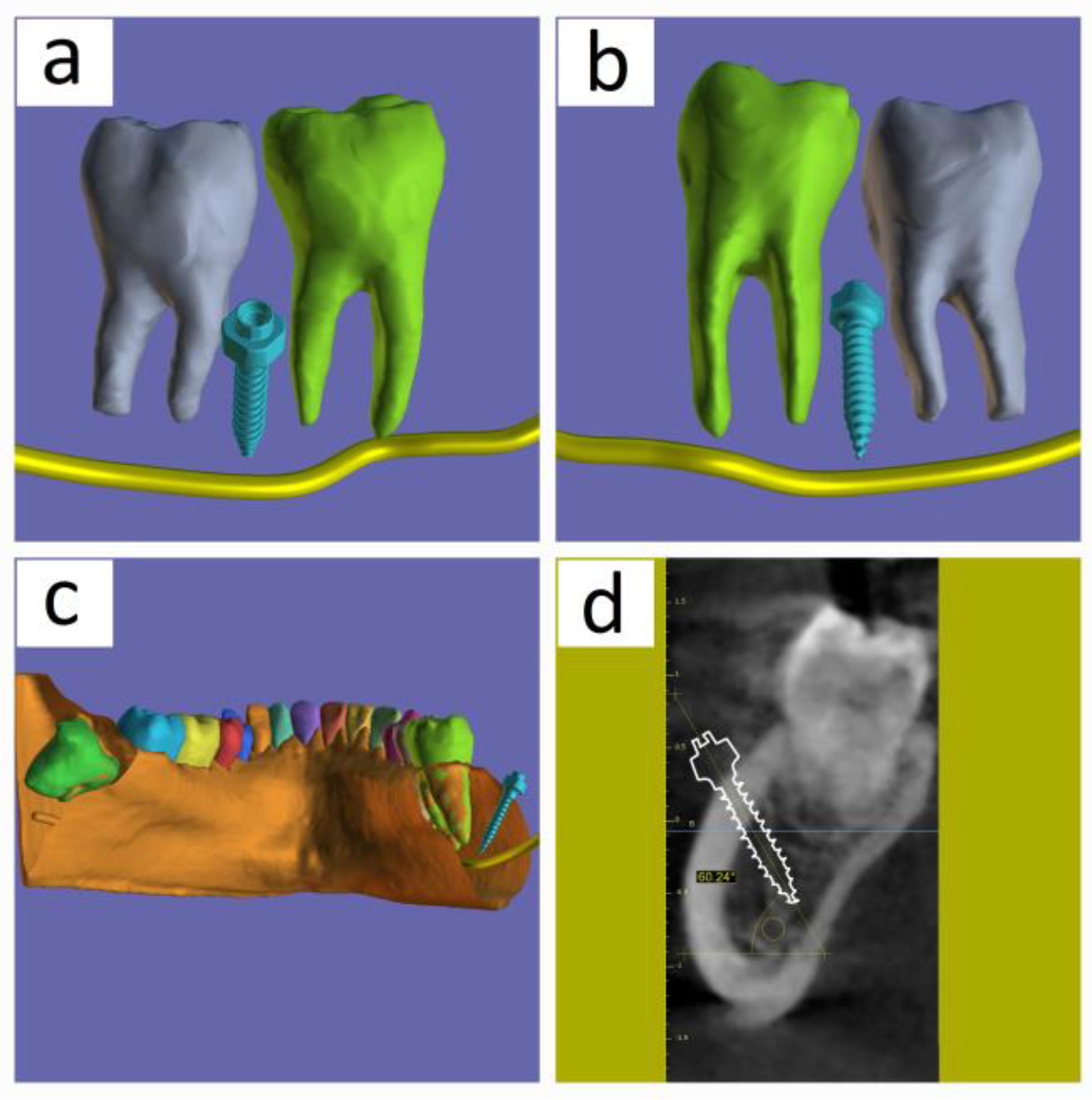 Medicina 60 01660 g006